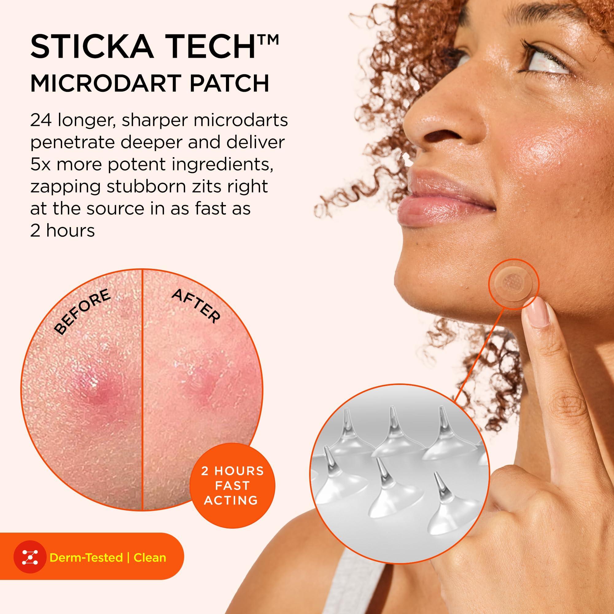 ZitSticka ZitSticka Extra Strength Killa Acne Patches for Face - World\'s Most Potent Pimple Patch with Fast-Acting Microdarts - Starts Working within 2 Hours for Deep, Early-Stage Zits & Blemish - 4 Count