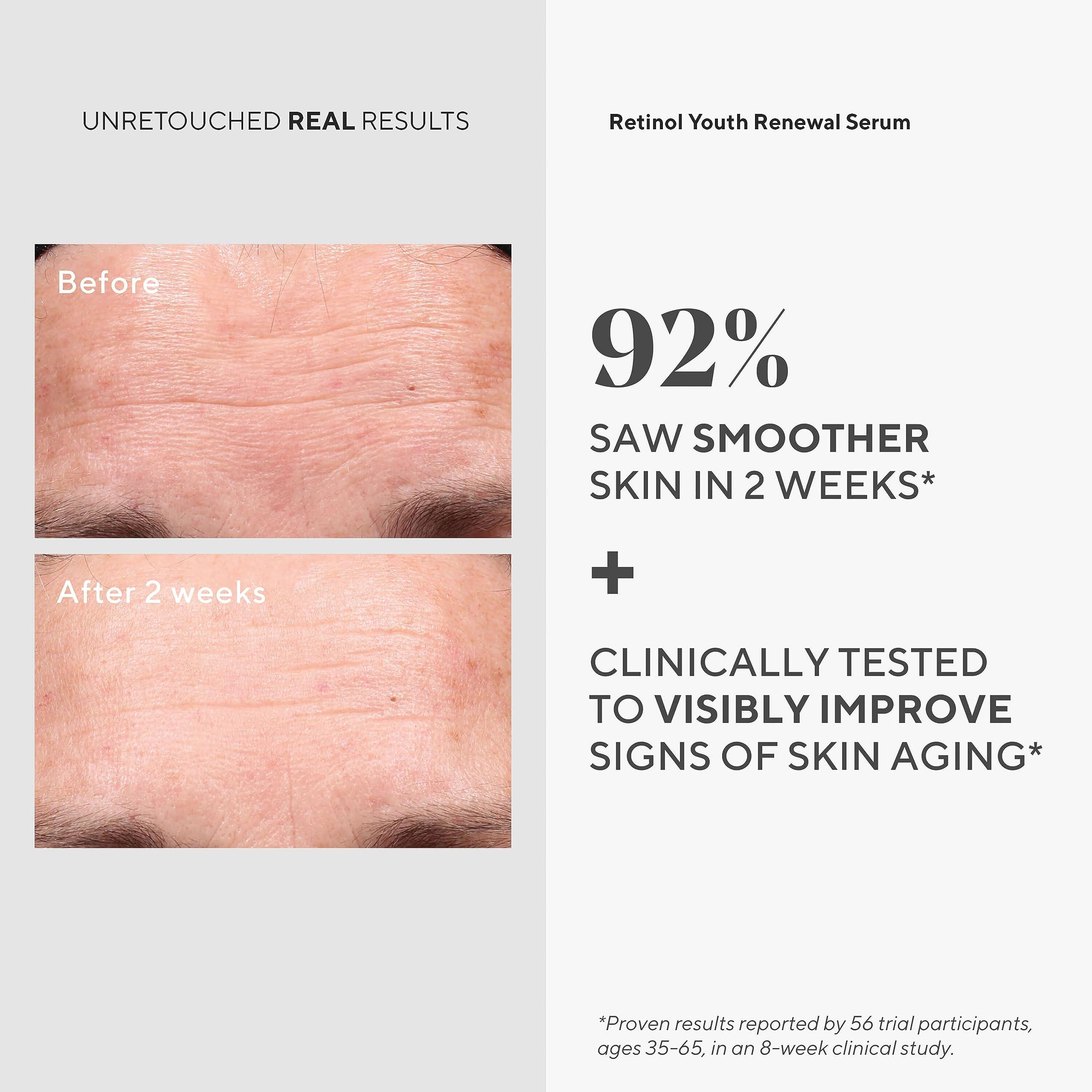 Murad Murad Youth Renewal Retinol Trial Kit – 3-Piece Trial-Size Kit $102 Value - Anti-Aging Retinol Skincare Set - Retinol Serum for Face, Retinol Eye Serum, & Retinol Night Cream