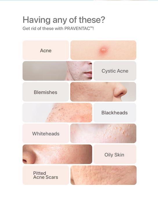 PRAVENTAC 60\'s Praventac Acne Treatment Remove Pimples Clogged Pores Blackheads Repair Skin Cells Dark Spots Whiteheads Backne