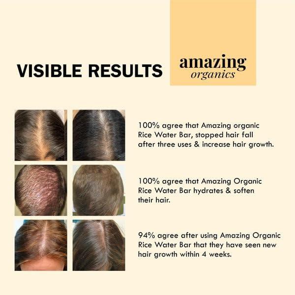 AmazingOrganics Rice Water Hair Growth Bar - Nourishing Shampoo Alternative, Organic Ingredients