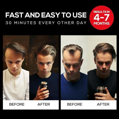 Kadielona Kadielona Laser Hair Growth Cap, Lightweight and Comfortable Device for Regrowth - Unisex Hair Loss Treatments Hat for Men Women - Red Light Therapy