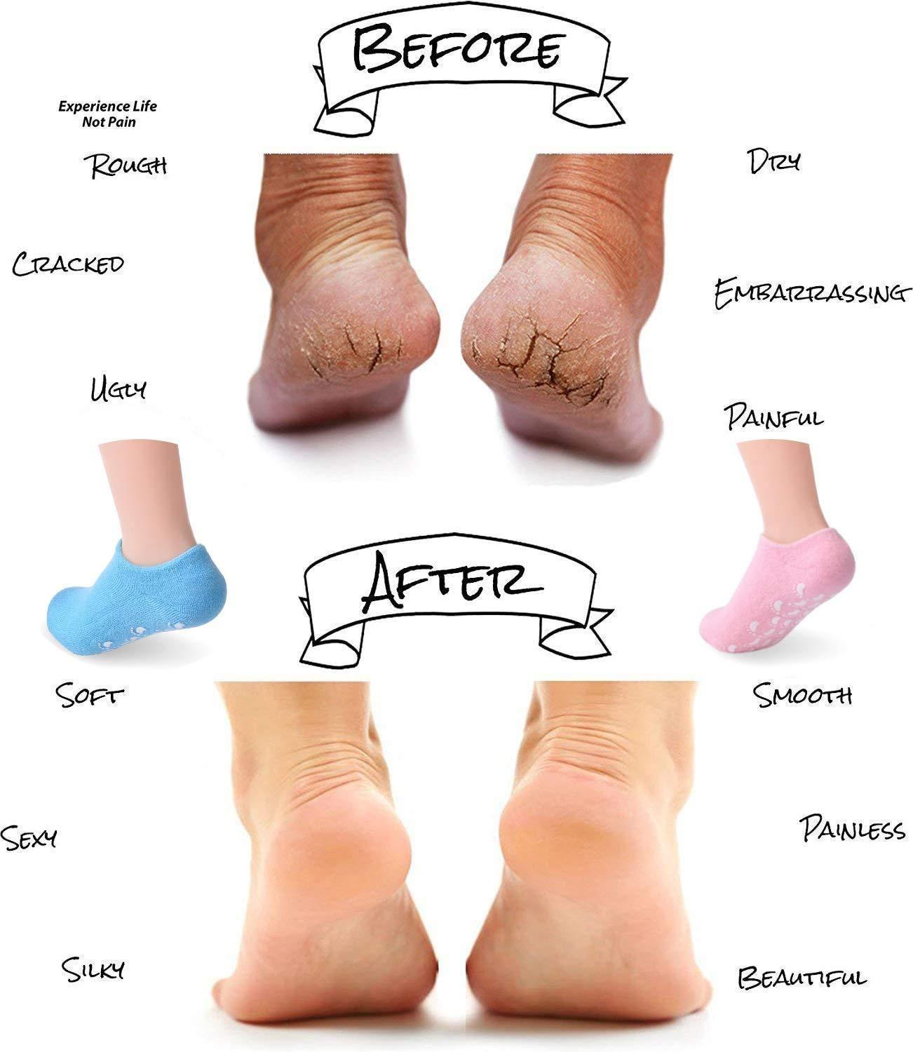 PRO 11 WELLBEING PRO 11 WELLBEING moisturising Socks for Dry Cracked feet (Pink)