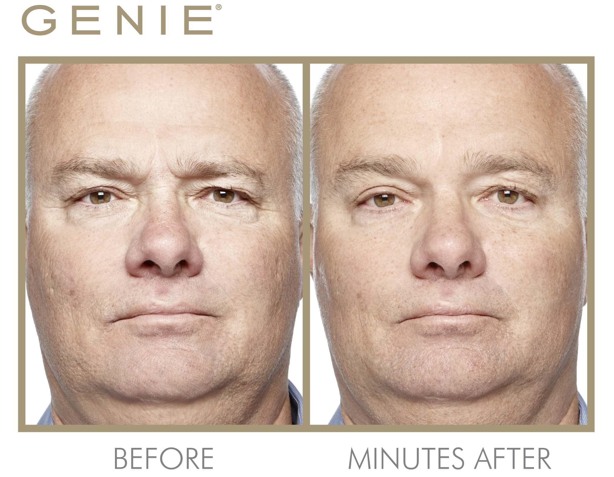 GENIE Beauty Products GENIE Instant Line Smoother (30 ml/1 fl oz)