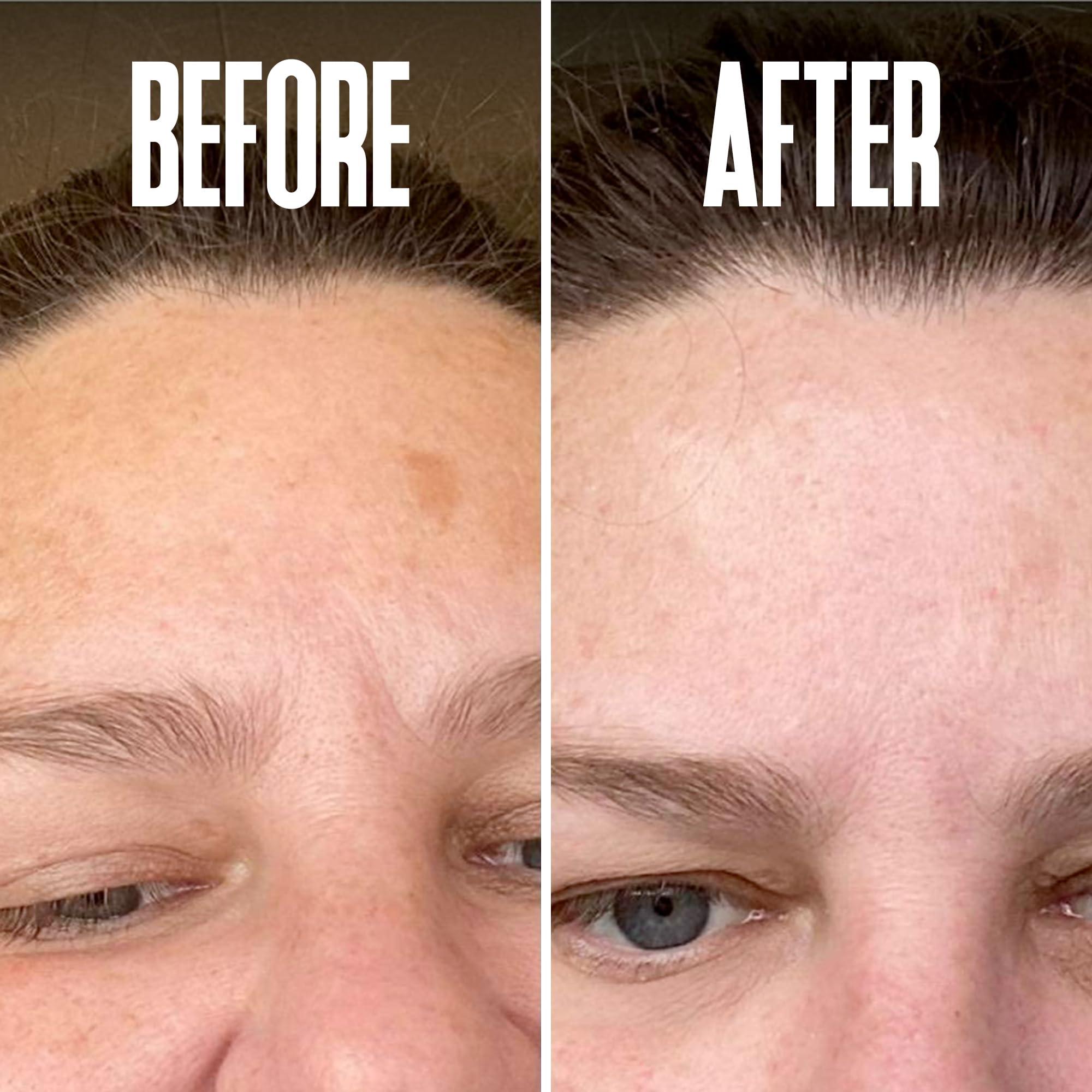 Divine Derriere Save 18% on The Skin Care Solution For Dark Spots, Razor Bumps, Ingrown Hair & Razor Burns – Includes Our Ultra Potent Brightening + Razor Bumps Pads For an Ultra Clear & Glowing Skin