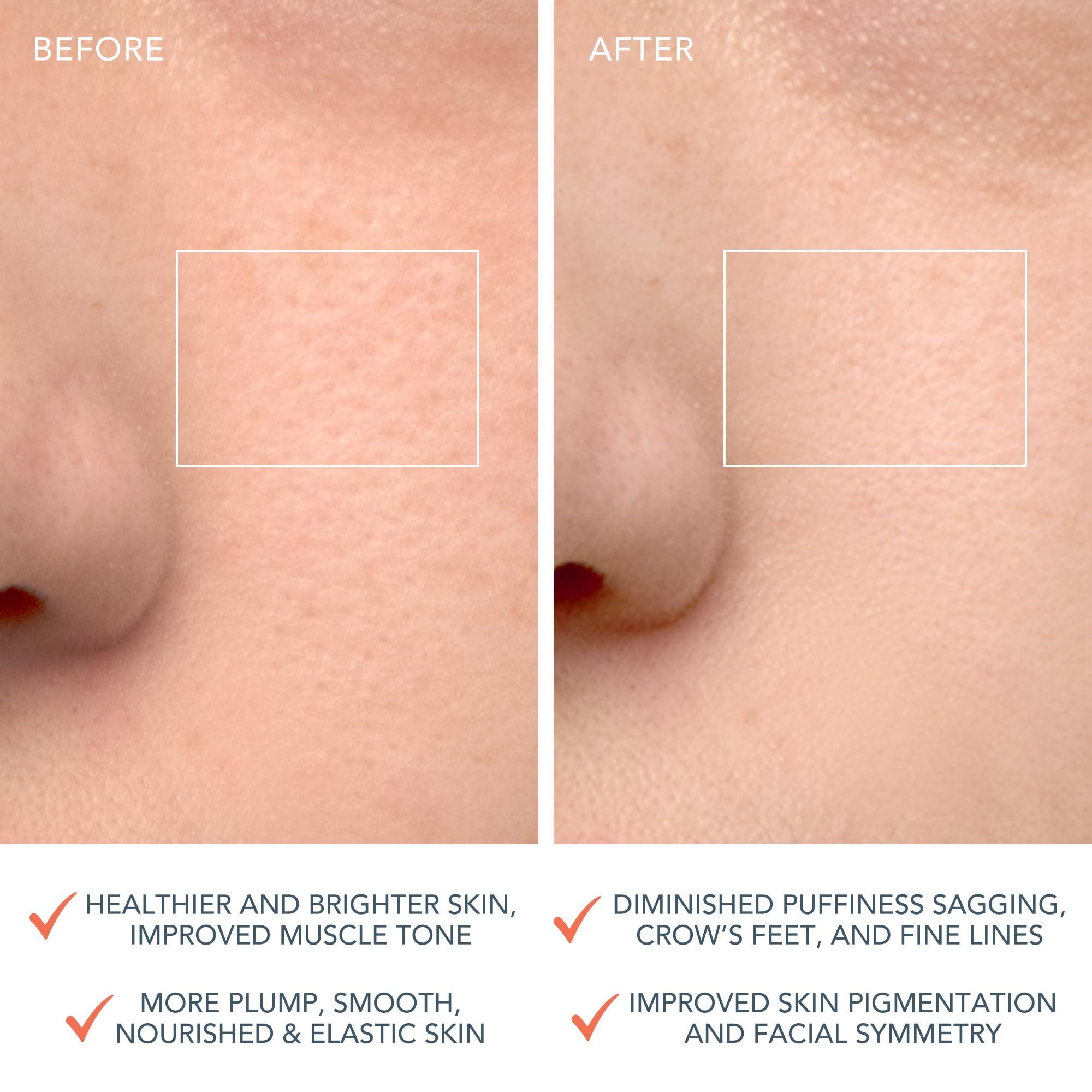 FOREO FOREO LUNA 4 Face Cleansing Brush - Anti Aging - Enhances Absorption of Facial Skin Care Products - Simple Skin Care Tools - Balanced Skin