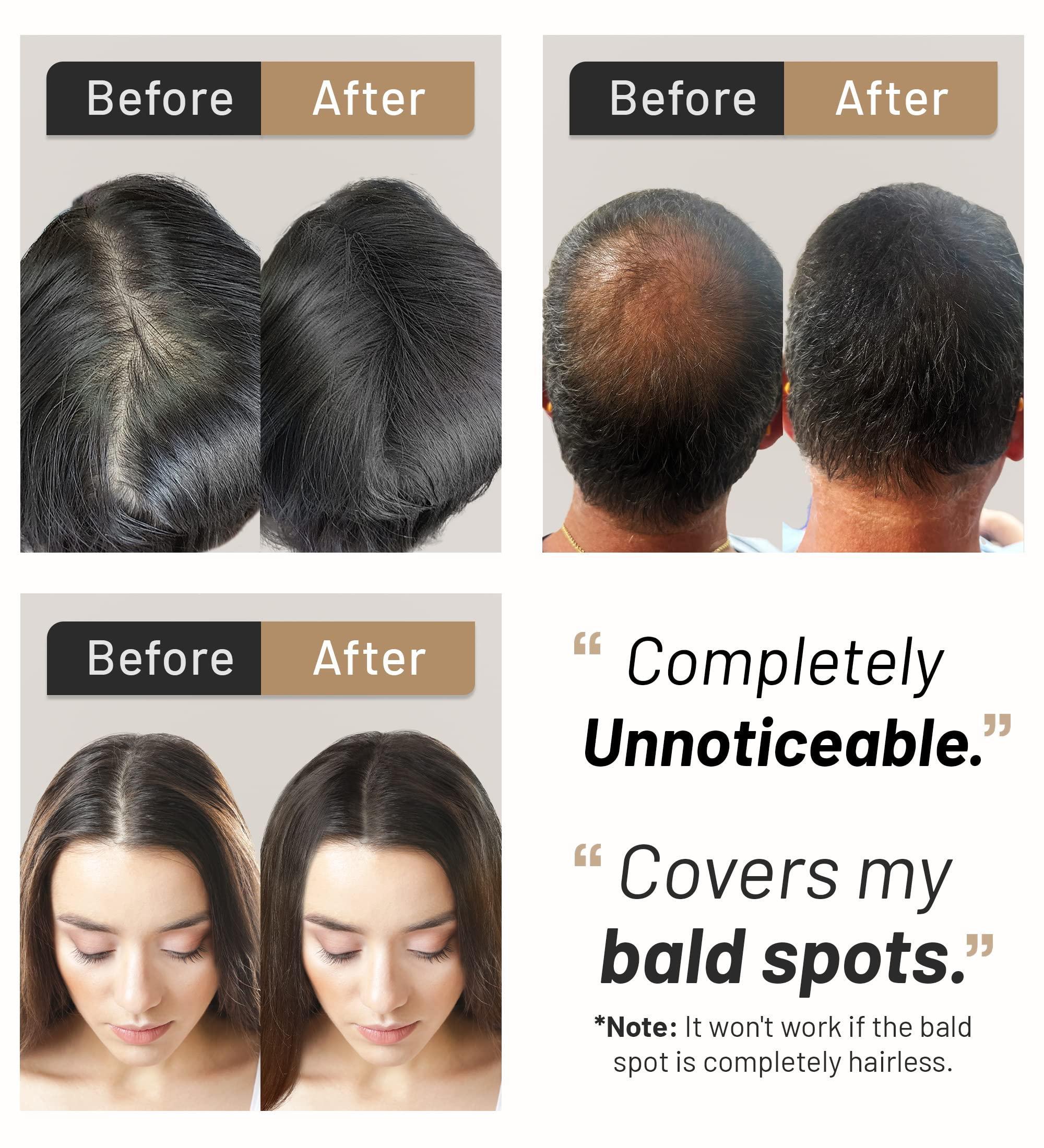 CONFIERR CONFIERR Keratin Hair Fibers for Men & Women - Fill In Fine or Thinning Hair, Instantly Thicker, Fuller Looking Hair (White 30g)