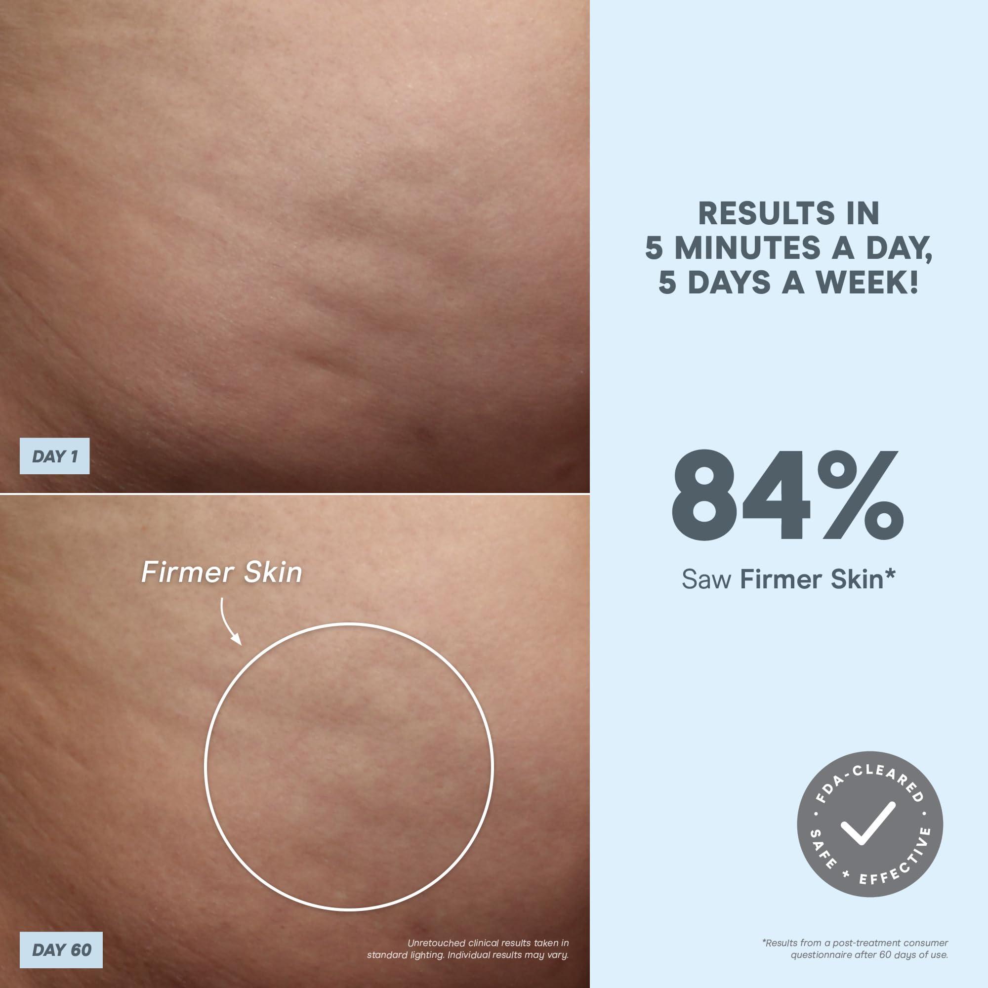 NuFACE NuFACE NuBODY Toning Device - FDA Cleared Microcurrent Device for All-Over Contouring, Firming & Skin Tightening