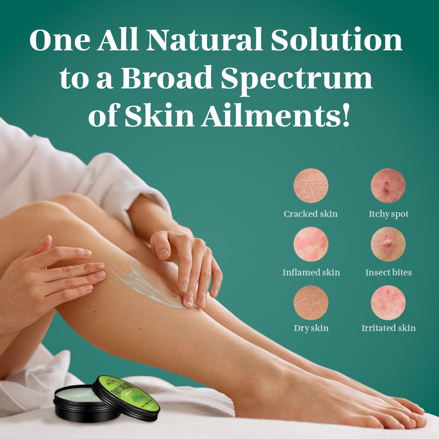 Pumice Valley Pumice Stone - Natural Earth Lava Black - Pumice Stone Foot File - Pumice Valley Foot Cream for Dry Cracked Heels and Feet - Rosemary Natural Foot Moisturizer Balm for Calluses and Dry Feet Treatment