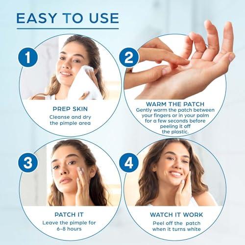 KEYCONCEPTS PatchRx Pimple Patches for Face (120 Patches), Hydrocolloid Acne Patches with Tea Tree Oil, Pimple Patch Pimple Stickers - Hydrocolloid Patch Acne Dots - Acne Pimple Patches For Face - Zit Patches