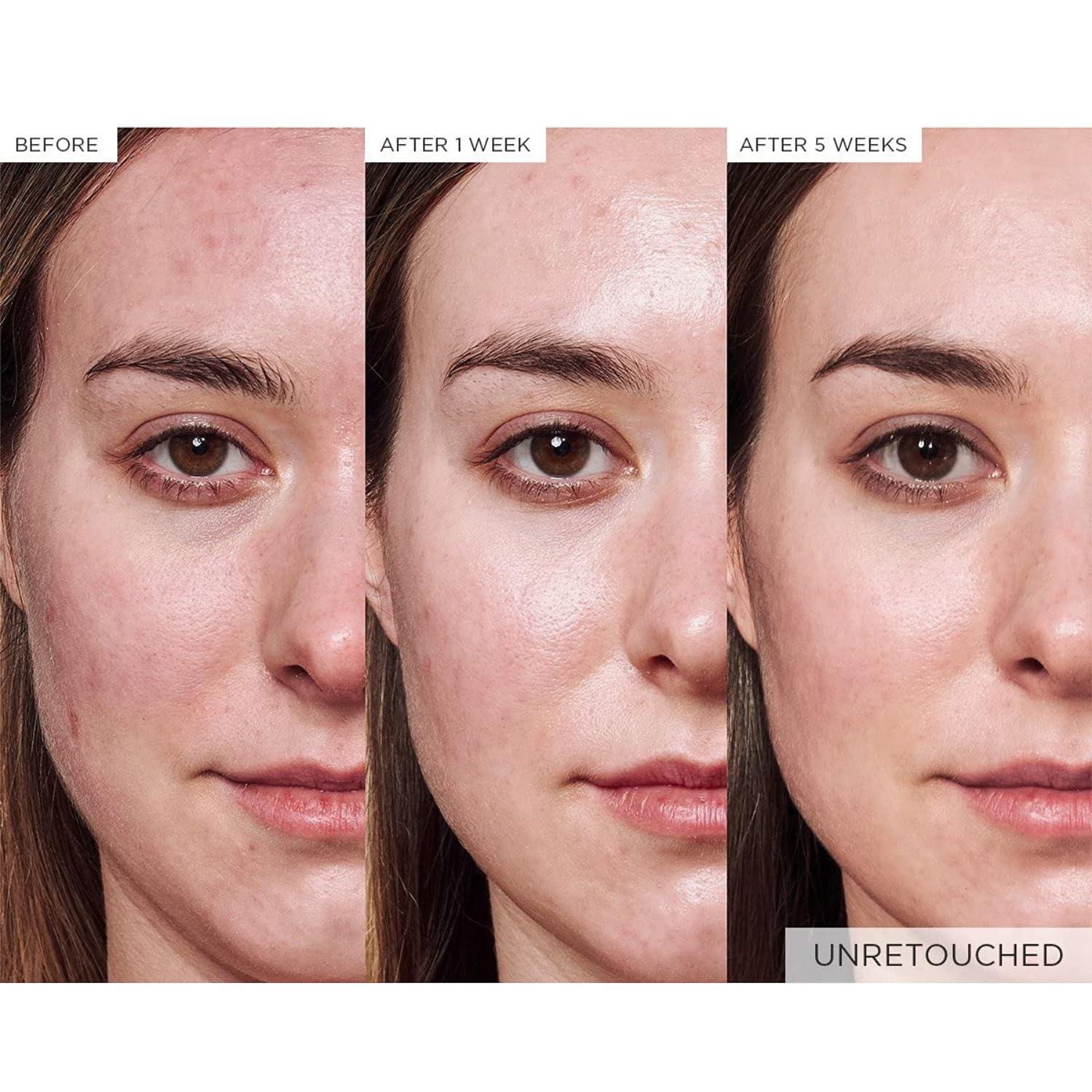 Glow Recipe Glow Recipe Brighten + Soothe Duo - Watermelon Glow Niacinamide Dew Drops (40ml) Highlighting Serum + Avocado Ceramide Recovery Serum (30ml) to Reduce Look of Redness, Uneven Tone, and Dark Spots