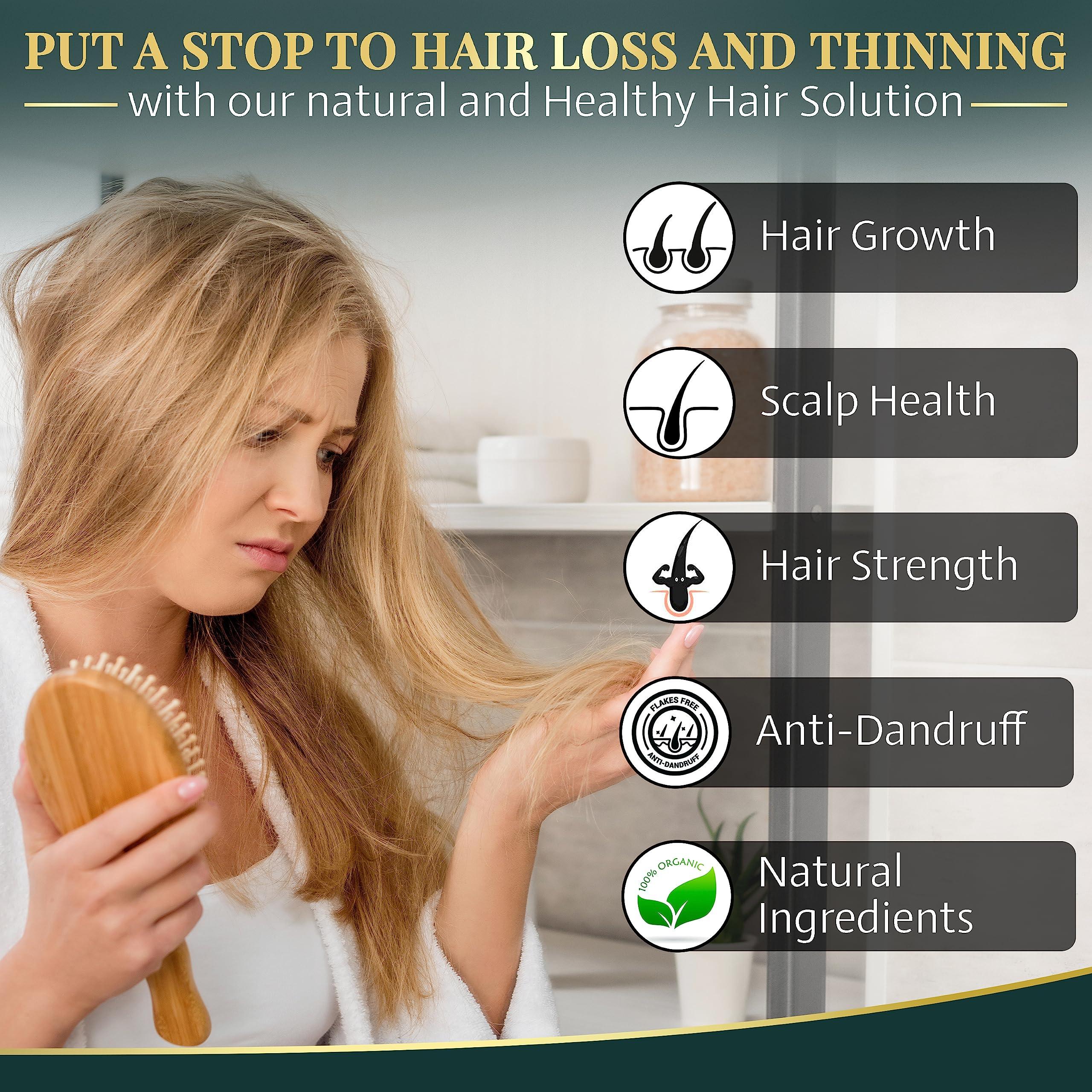 Aroma Dead Sea Aroma Dead Sea Black Mud Shampoo - Fights Dandruff, Thinning Hair, Weak Roots & Itchy Scalp. Prevents Hair Loss & Encourages Growth. Ideal for Damaged Hair (12.85 fl.oz)