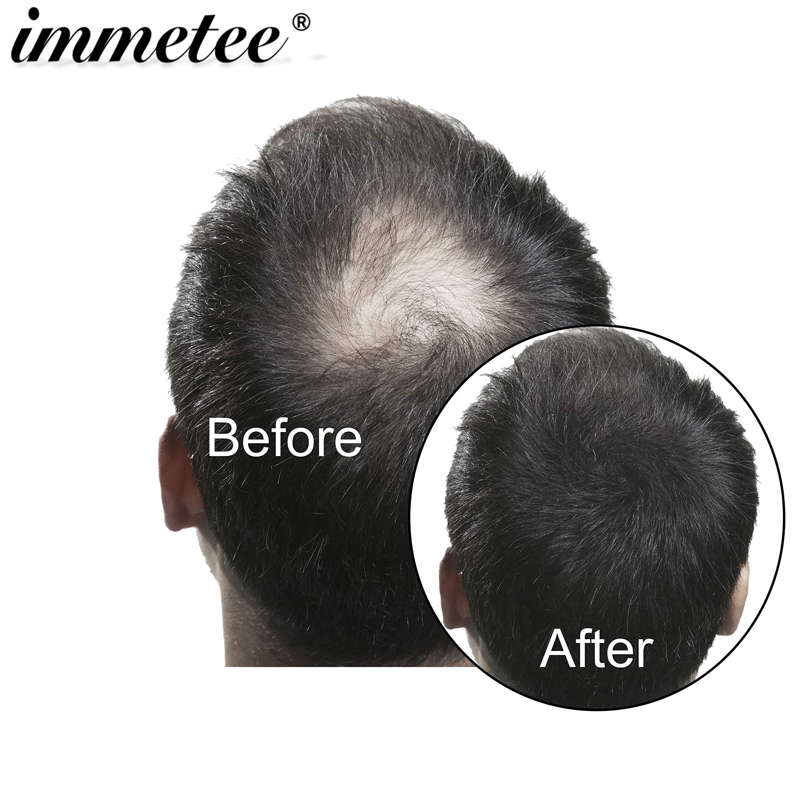 immetee immetee Hair Building Fibres Powder, Hair Fibres for Women & Men, 28g