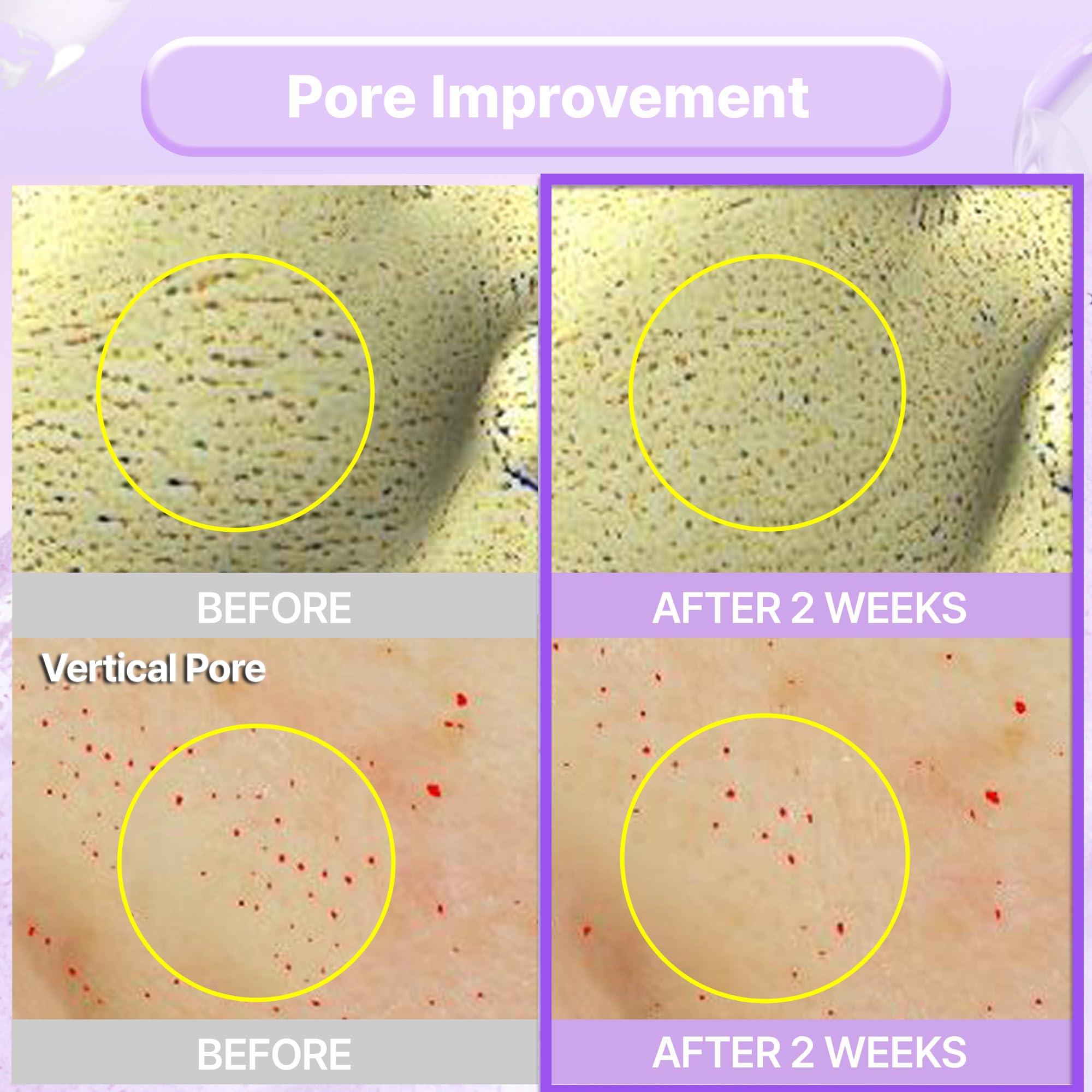 BIOHEAL BOH BIOHEAL BOH Probioderm Collagen Remodeling Serum 1.01 fl oz (30 ml) | Skin Firming Serum with Collagen & 12 Peptides for Pore Tightening & Smoothing | Hydrating & Lifting for Daily Skincare