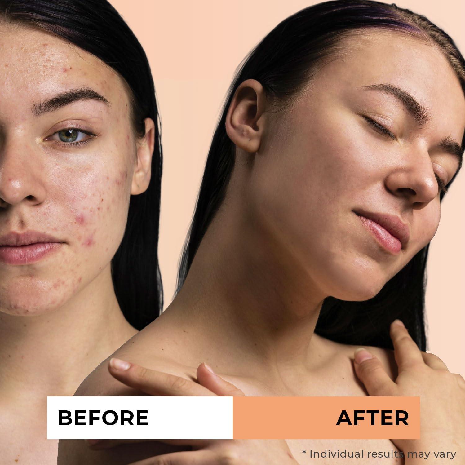 Jeune Naturelle Jeune Naturelle Sea Buckthorn Oil Organic, From Fruit & Seeds, 100% Pure RAW Virgin Cold-Pressed Undiluted Unrefined, Fast Absorbing, Travel Size, Non-Comedogenic