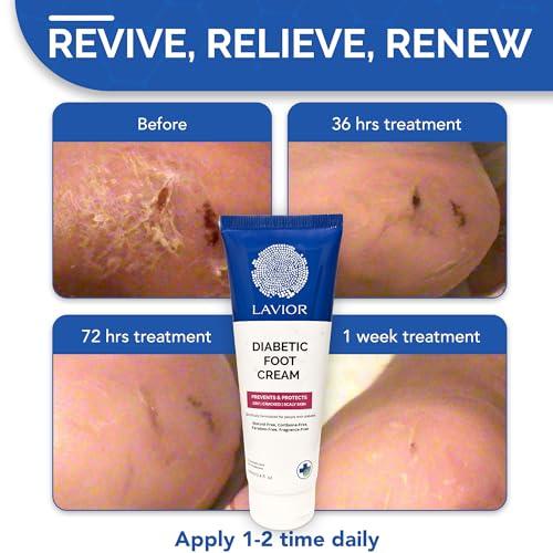 Lavior Lavior Diabetic Foot Cream - Intensive Moisturization & Relief | Natural & Non-Toxic | Doctor Recommended, Clinically Proven | Hypoallergenic, Vegan | Made in USA