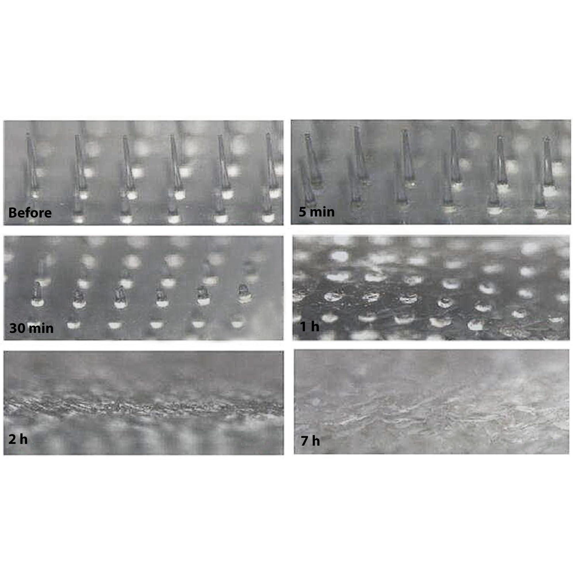 Frilliance Frilliance Microdart Hydrocolloid Acne Pimple Patches for Zits and Blemishes (4 count) Spot Treatment Stickers for Face & Skin, Vegan and Cruelty Free (Deep Dive Micro Darts)