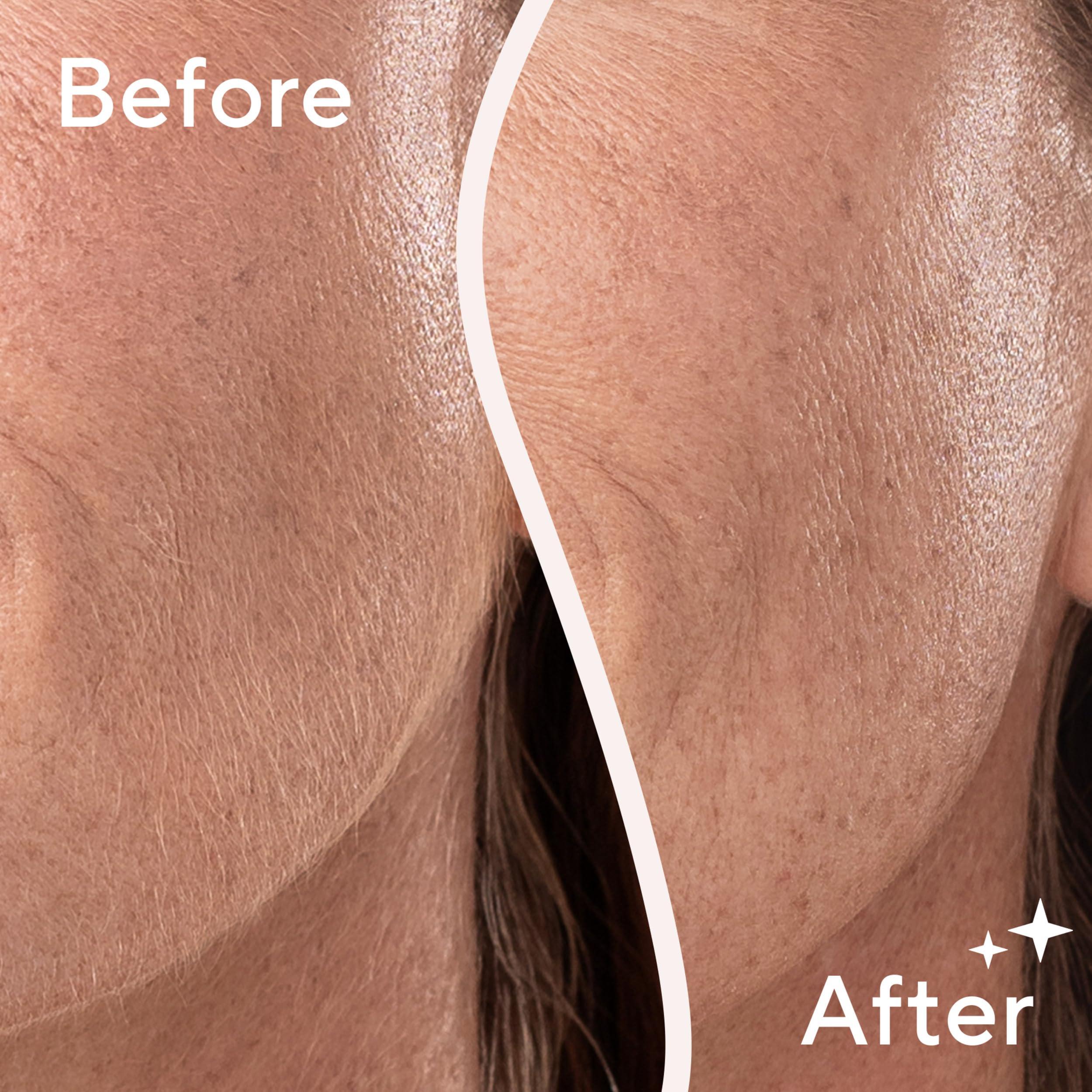 Finishing Touch Flawless Finishing Touch Flawless Dermaplane Glo Sonic Lighted Facial Exfoliator, Electric Vibrating Dermaplane Razor for Dermaplaning, Facial Hair Removal, 6 Replacement Heads