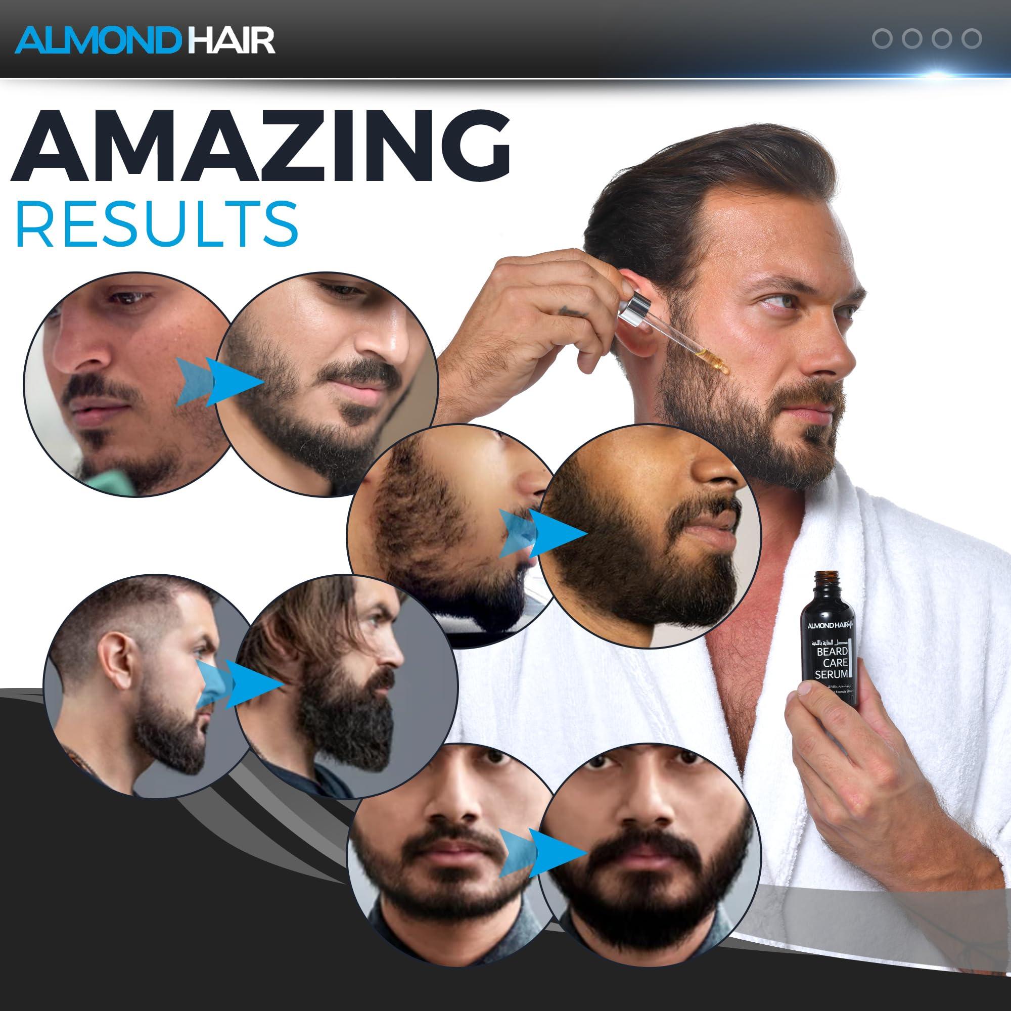 almond hair Almond Beard Serum for Men  50ml Professional Beard Growth Oil  Natural Hair and Beard Care with Biotin for Nourishment and Thicker, Fuller Growth (1 Pack)