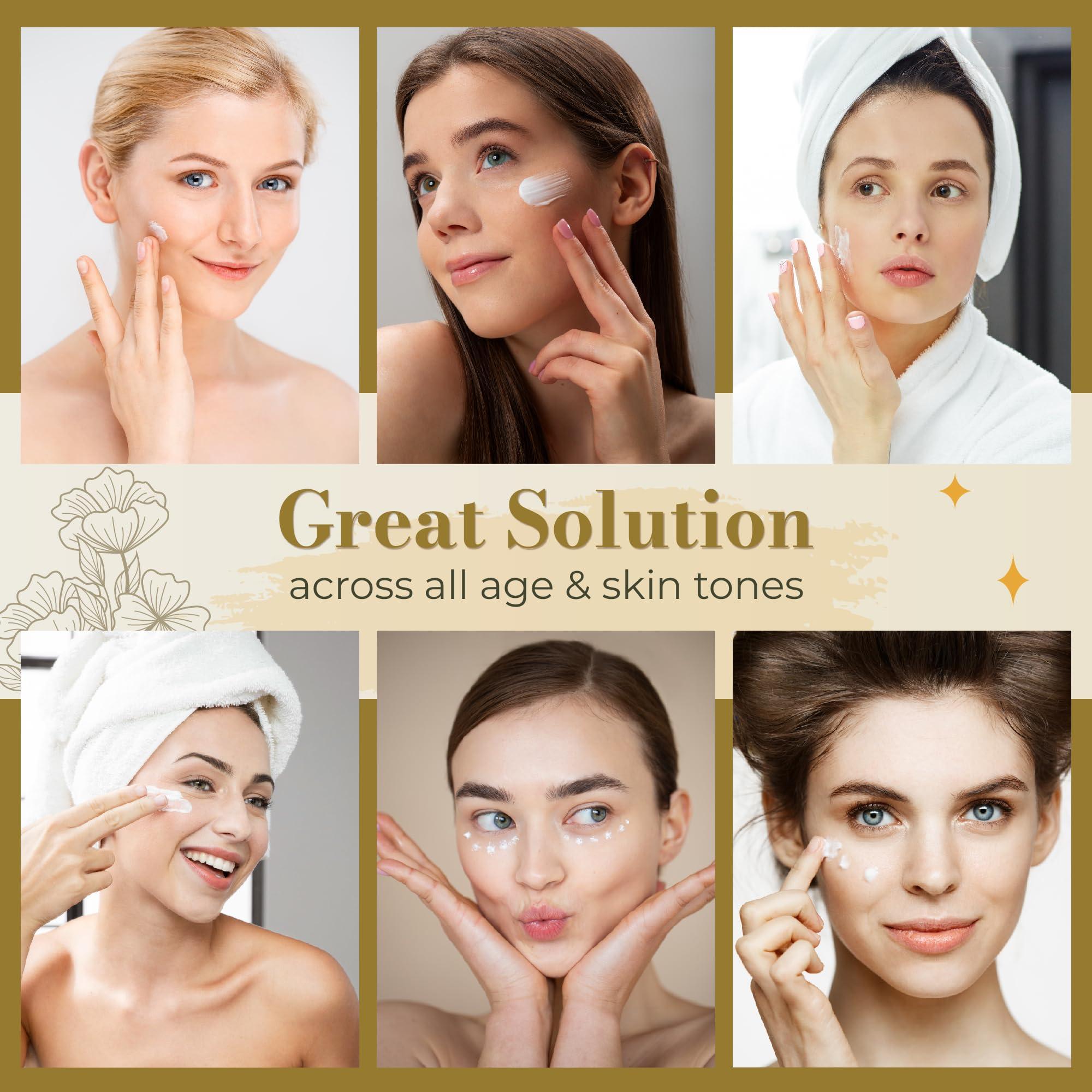 ABERA ABERA Dark Spot Remover for Face: Dark Spot Corrector for Age Spot Sun Spot Freckles Melasma Brown Spot - Faded Spot Correcting Cream for Face Hands (3 Boxes)