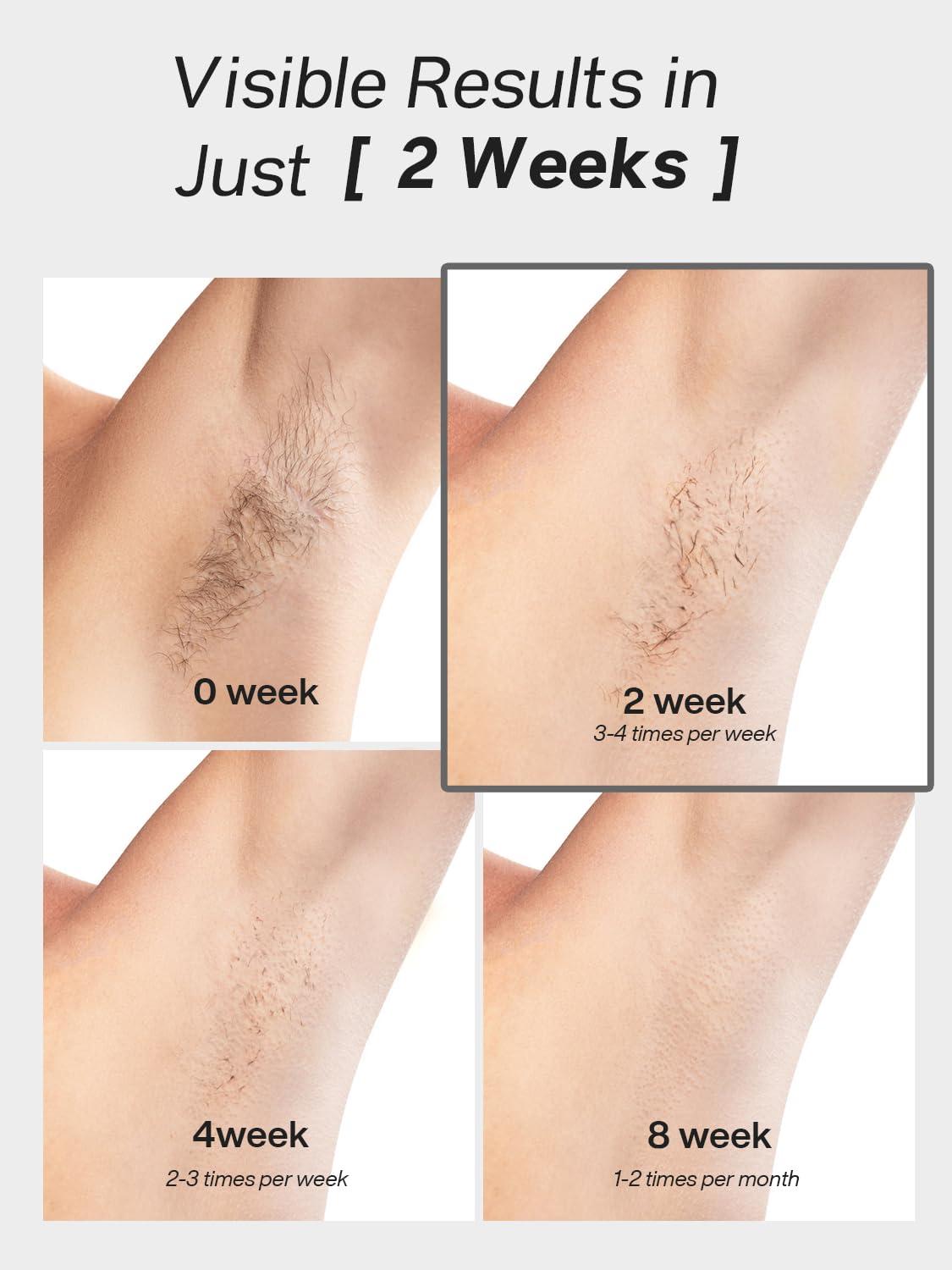 Blex Blex Laser Hair Removal for Women and Men, IPL Hair Removal Device Effective in 2 Weeks, with Ultra-Fast 0.2s Light Emission, Comfortable and Painless