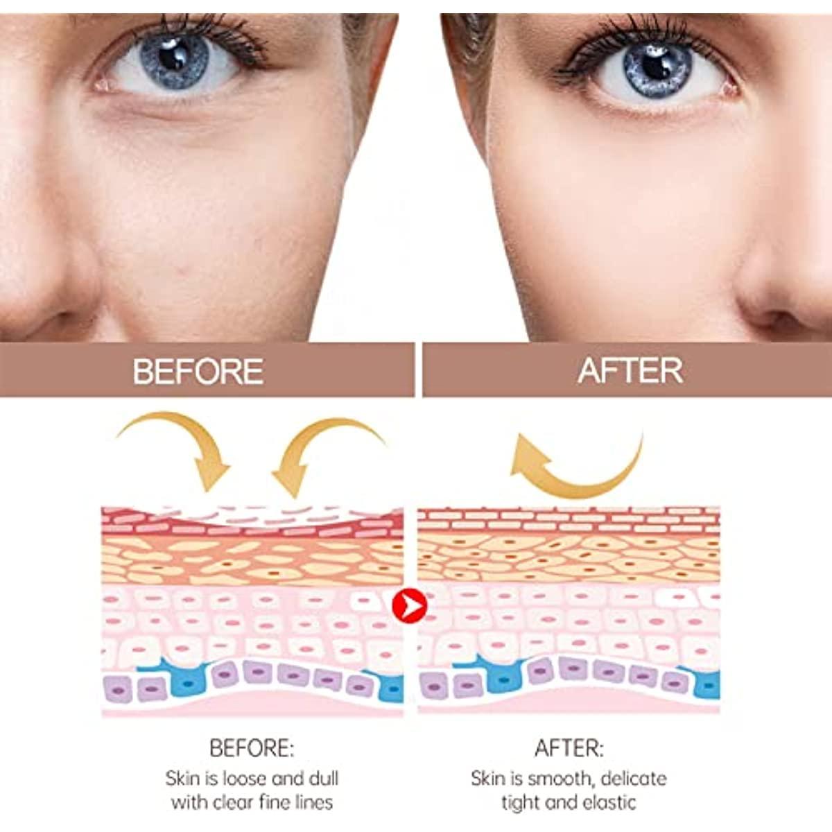 Generic 3PCS Wrinkle Bounce Moisturizing Balm, Wrinkle Multi Balm Stick, Multi-Moisture Balm Stick, Anti-Aging and Anti-Wrinkle Balm Sticks for Face and Neck