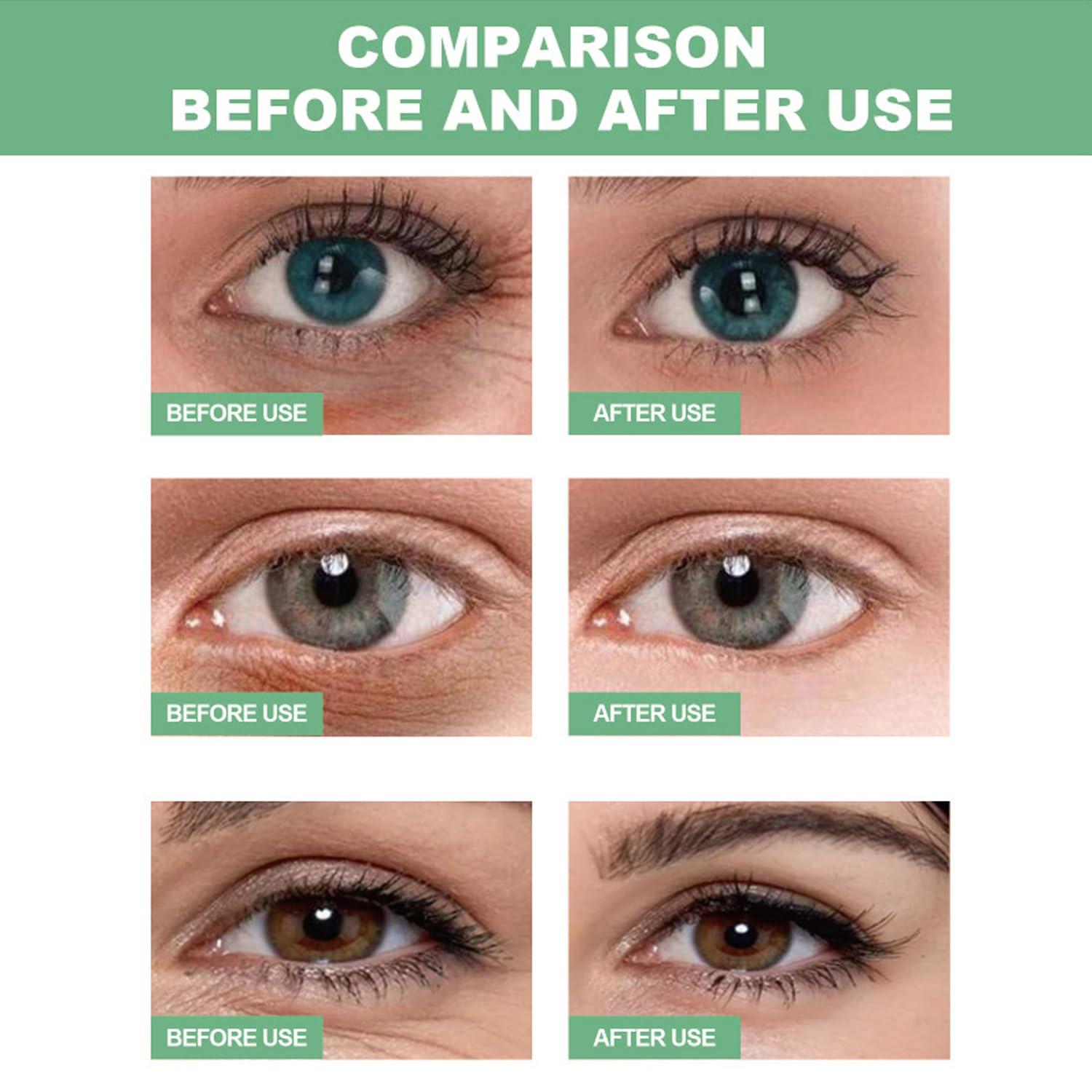 firstfly 60 PCS Aloe Vera Eye Masks, Gel Collagen Under Eye Patches for Puffy Eyes and Dark Circles Treatments, Reduce Wrinkles and Fine Lines Undereye Patches