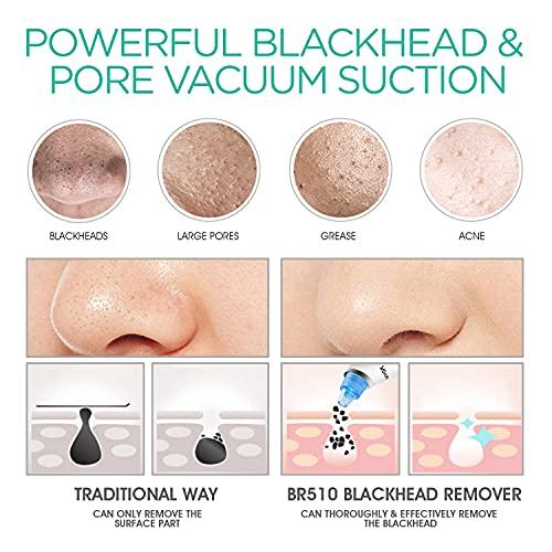 VOYOR VOYOR Blackhead Remover Pore Vacuum - Electric Face Vacuum Pore Cleaner Acne White Heads Removal with Suction Heads (BR510)