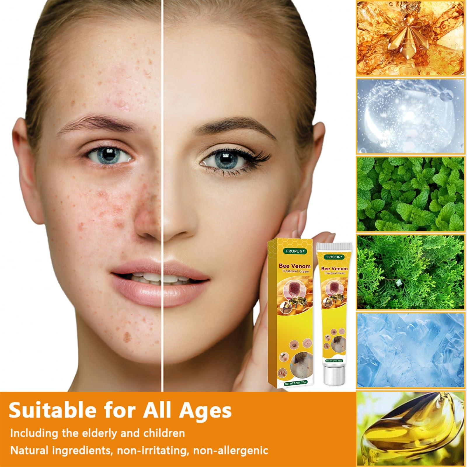 TLOPA TLOPA Bee Venom Treatment Cream, New Bee Venom Repair and Removing Cream,Hydrating Moisturizing Treatment cream for Men&Women,1Fl Oz (4)