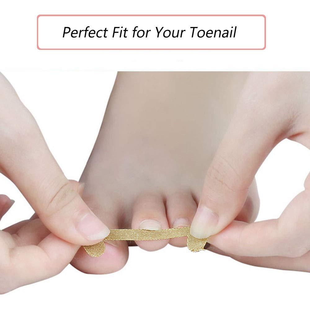 EBANKU EBANKU Ingrown Toenail Treatment Strips, 20 Pcs Toe Nail Correction Patch Elastic Patch Sticker Corrector Pedicure Tools Fingernail Toe Nail Care