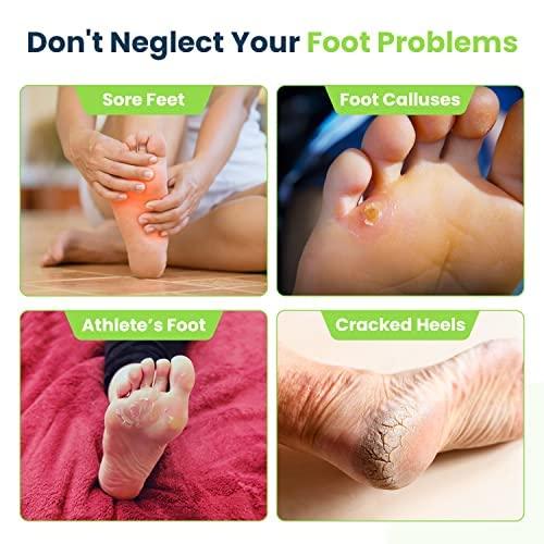 FOOT CURE Tea Tree Oil & Soothing Lavender Foot Soak with Epsom Salt Callus Remover for Feet with Extra Strength Gel & Foot Pumice Stone Set