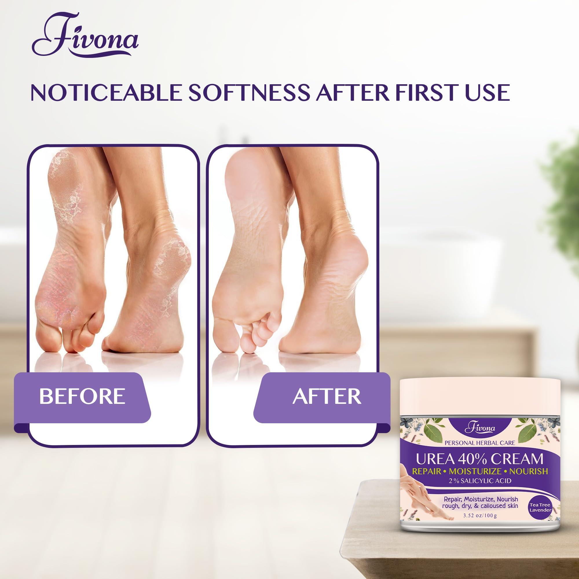 FIVONA FIVONA 40% Urea Cream with 2% Salicylic Acid - Foot Cream with Tea Tree and Lavender Extracts Foot Lotion for Dry Cracked Heels, Dead Skin & Callus Remover, Feet Moisturizer Repair Cream