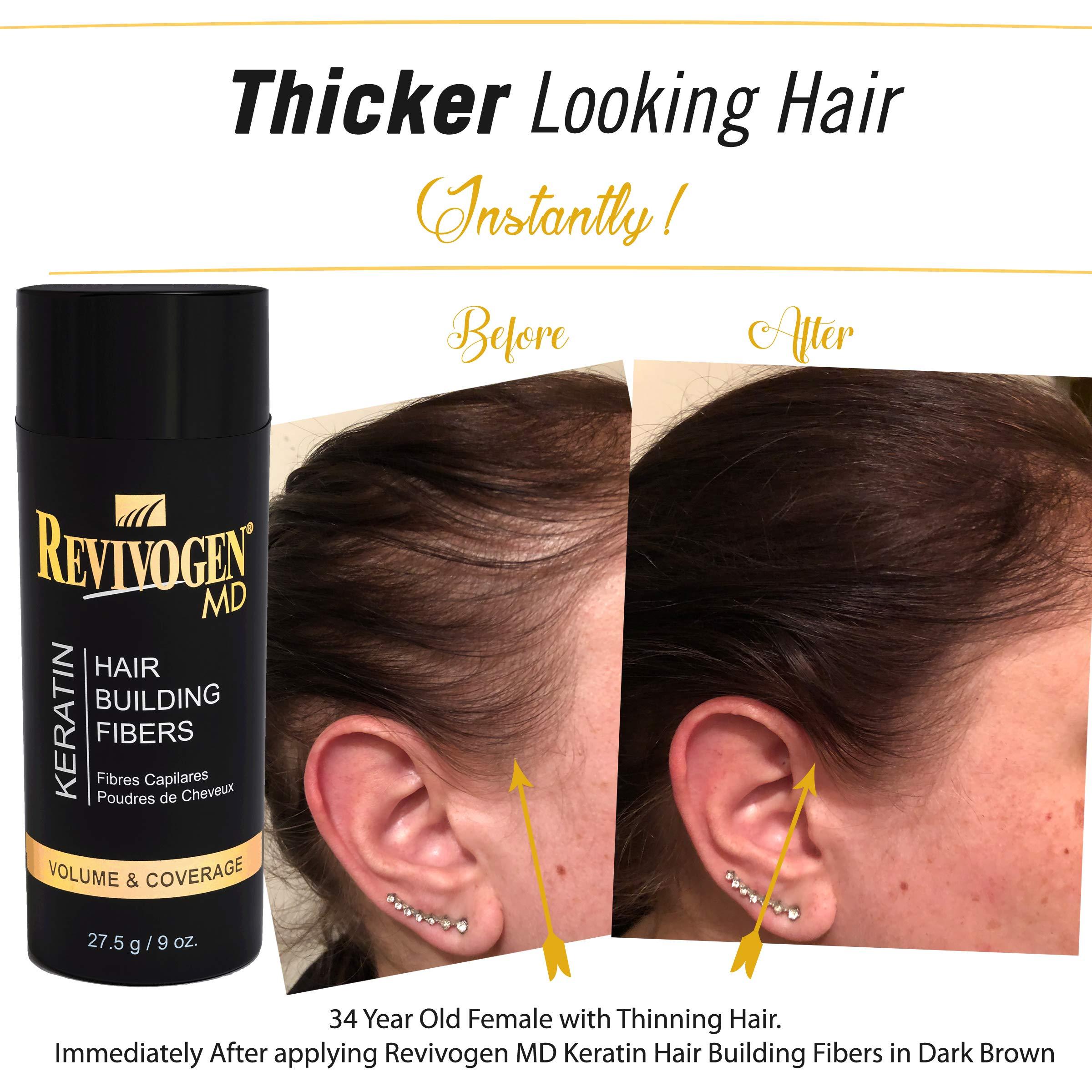 Revivogen MD Revivogen MD Keratin Hair Building Fibers, Hairline Powder, Hair Fibers, Hair Fibers for Thinning Hair, Hair Fiber Spray, Thick Fiber for Hair Men and Women, Hair Filler, 9oz, Black