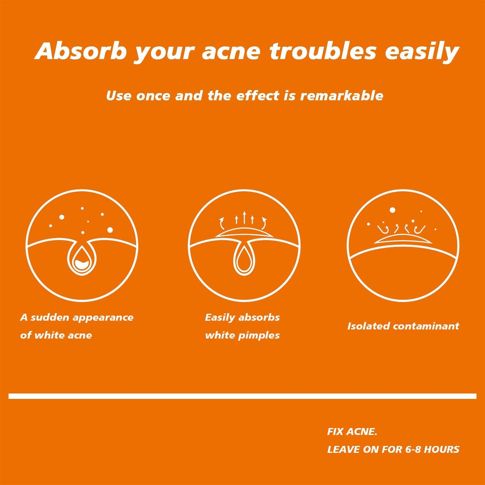 Leoezx Leoezx Acne Pimple Patches 72 Pcs,Acne Spot Dots,Facial Acne Patch,Hydrocolloid Acne Patch for Face,All Skin TypesAcne Patch & Pimple Patch