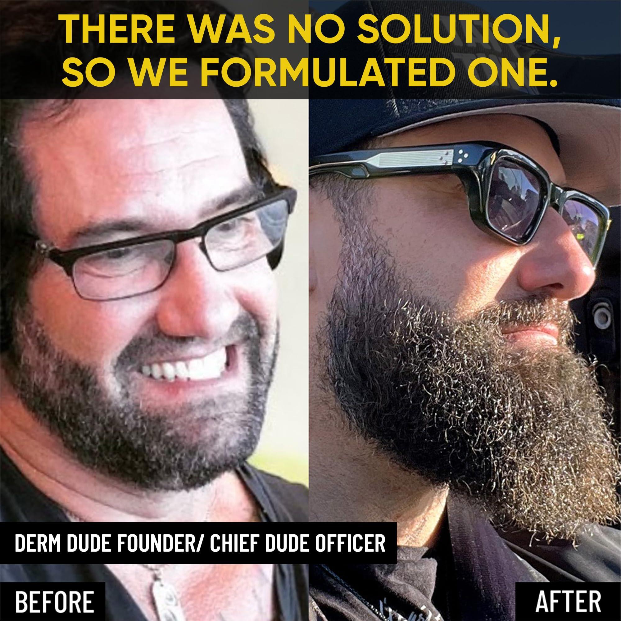 Derm Dude Derm Dude Biotin Beard Growth Spray for Men | Formulated with Biotin & Bamboo Extract for Hair Growth | Promotes Thicker Fuller Beard | For Stronger Healthier Beard Growth, Non-Greasy Grooming- 1 oz