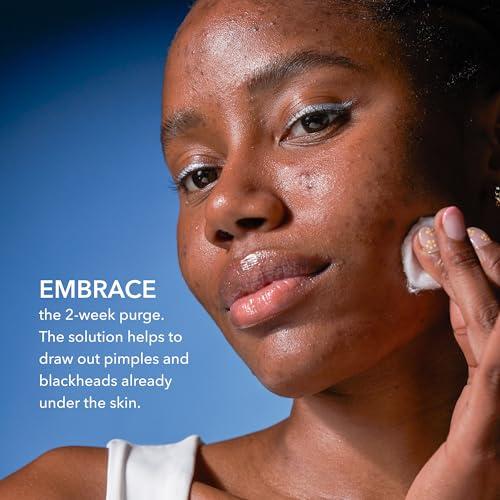 Dr Dennis Gross Dr Dennis Gross Alpha Beta 2% BHA+ Breakout Solution, Minimizes Pores, Clear & Prevent Breakouts, 5 Fl Oz