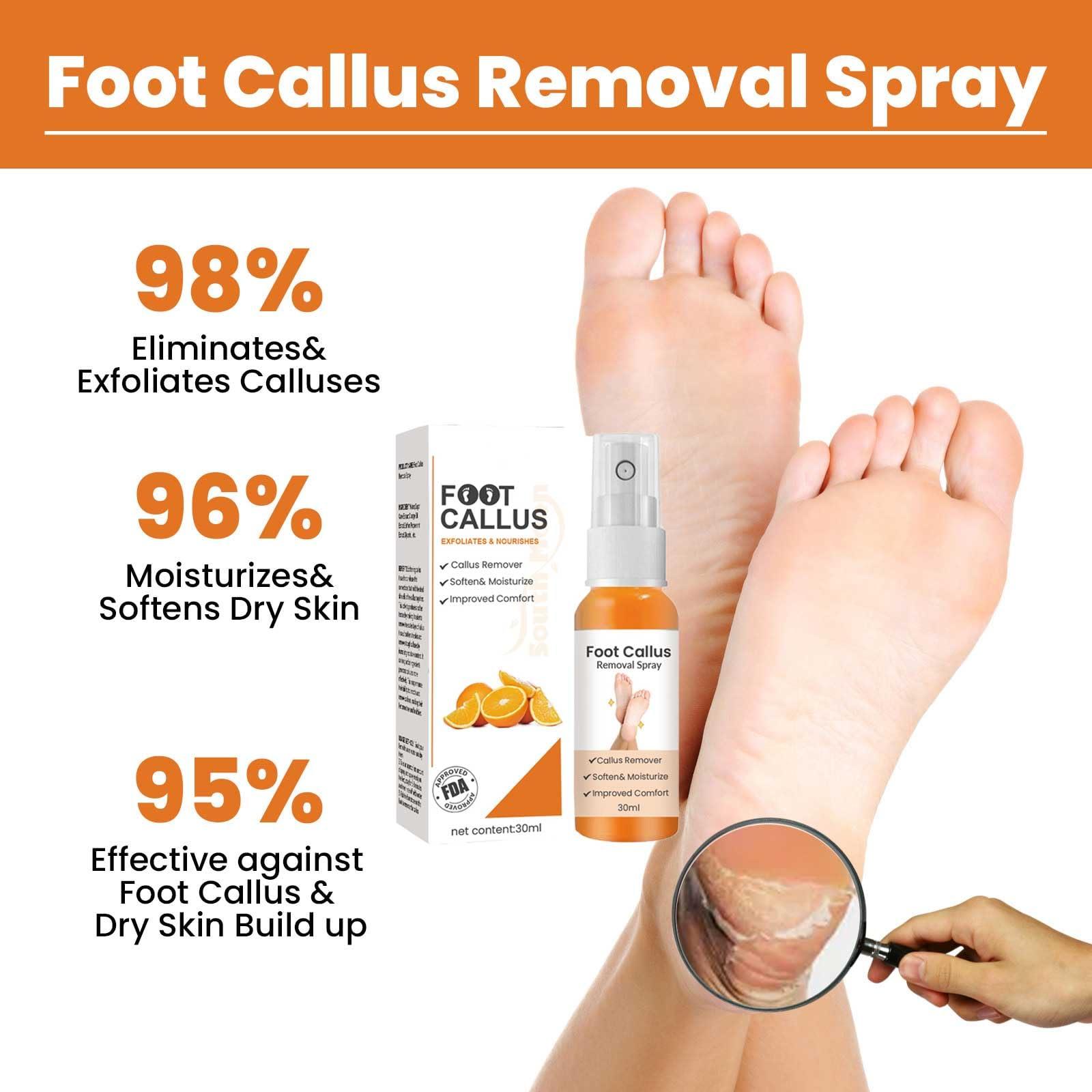 LOEBKE Foot Callus Removal Spray,Foot Heel Callus Remover Spray,Foot Peeling Spray Orange Oil,Foot Peel Spray That Remove Dead Skin,Exfoliating Peeling & Calluses On Feet (1PCS)