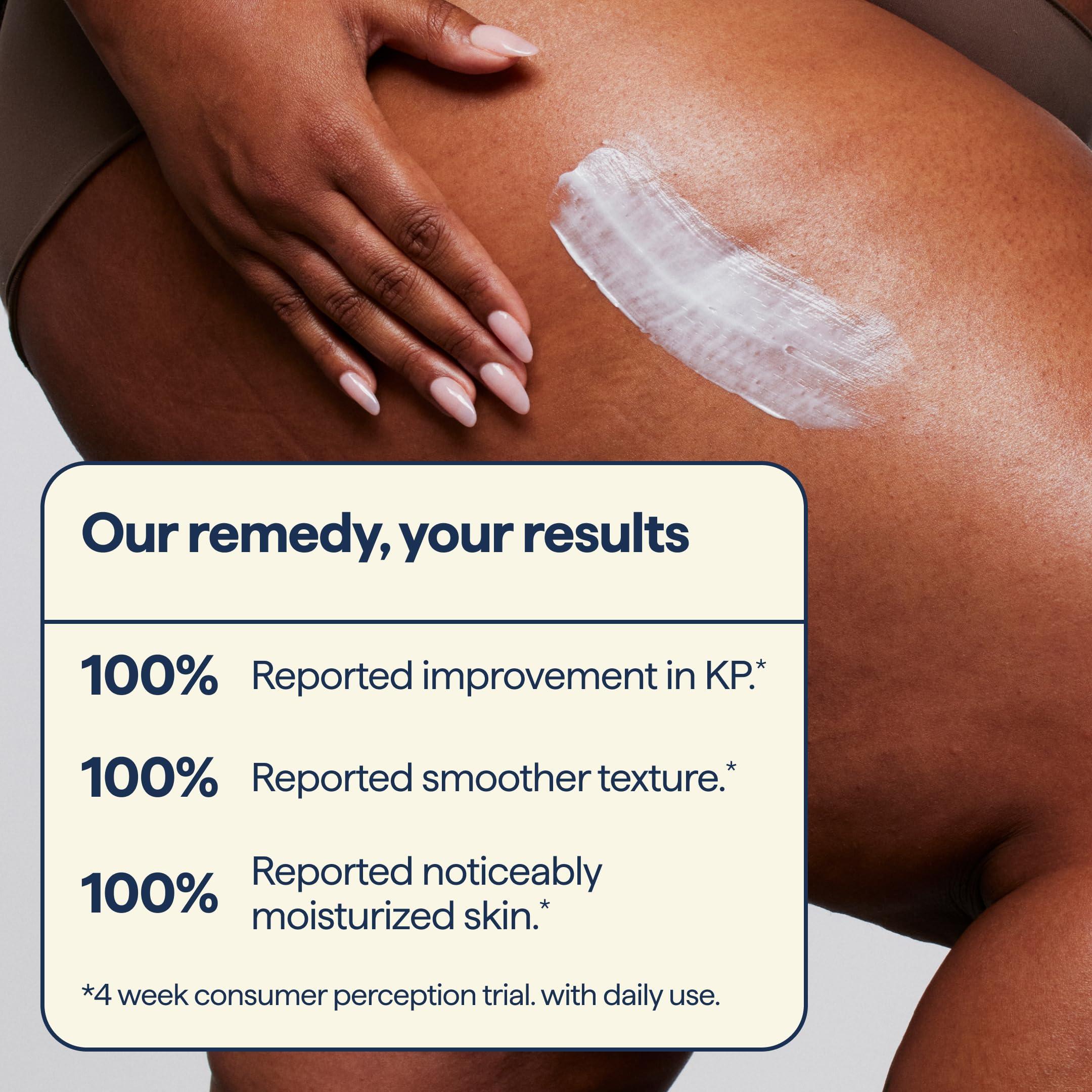 Remedy Science Remedy for Body Bumps Treatment for Keratosis Pilaris (KP) and Textured, Crepey Skin with Urea, Lactic Acid, and Retinol - Smoothing Body Moisturizer Lotion By Dermatologist Dr. Shah