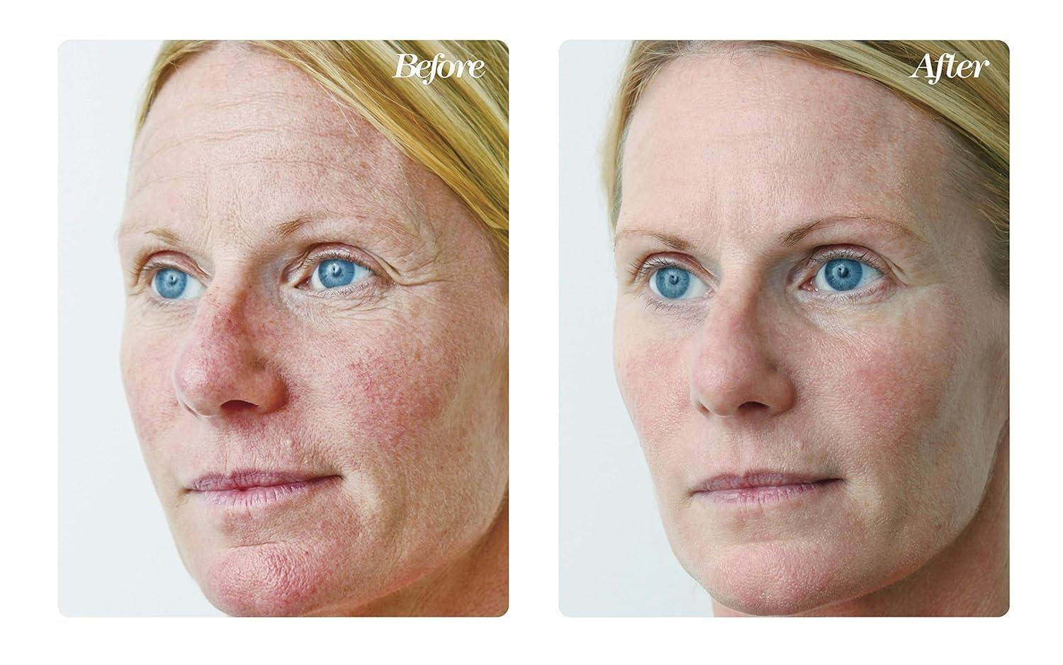 Osmotics Cosmeceuticals Osmotics Blue Copper 5 Firming Elasticity Repair Anti-Aging Cream for Wrinkles, Firmness, and Acne. Visible Results Quickly. Made in the USA