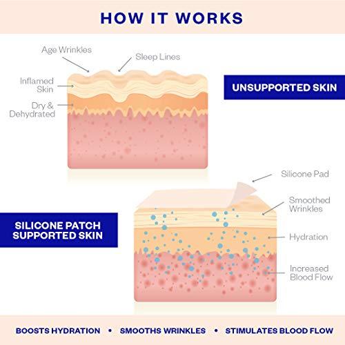 Wrinkles Schminkles Wrinkles Schminkles Chest, Cleavage & Body Stretch Mark Wrinkle Patches | Reusable Hypoallergenic Pregnancy Safe Silicone Smoothing Pads to Prevent and Reduce Wrinkles & Stretch Marks | 2 Pack