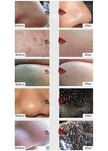AICHUN BEAUTY AICHUN BEAUTY Blackhead Facial Mask, Peel Off Mask,Blackhead Remover Black Mask Deep Clean Mask, Bamboo Charcoal Deep Cleansing Blackhead Remover Purifying Peel Face Mask 50g