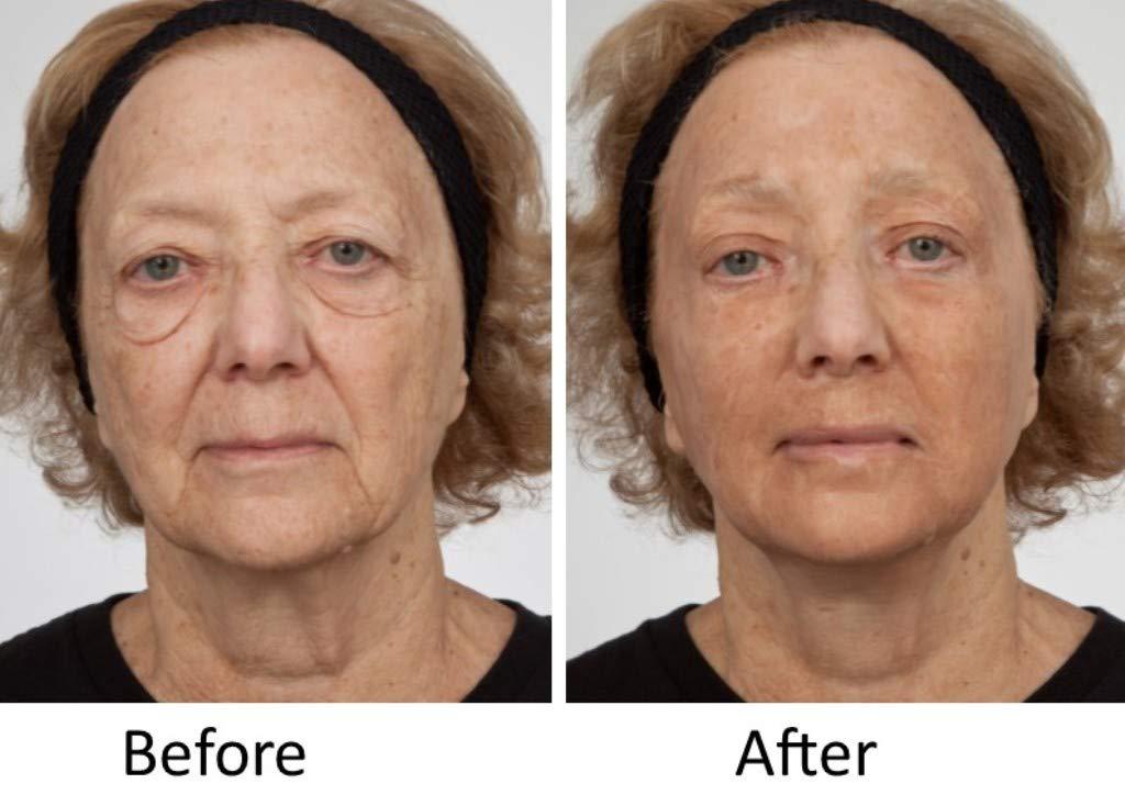 Dr.Sevinor Skincare Solutions Dr Sevinor Wrinkle Solution Wrinkle Smoothing Tinted Serum 1 FL OZ