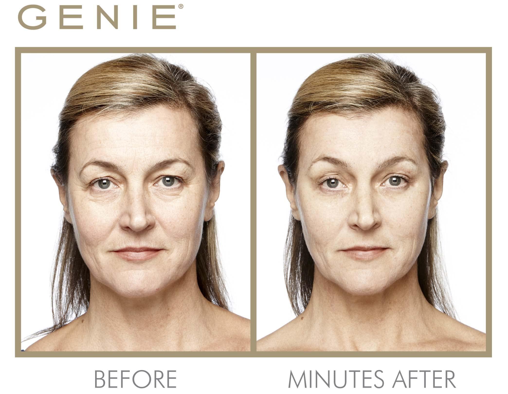 GENIE Beauty Products GENIE Instant Line Smoother (30 ml/1 fl oz)