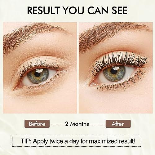 Simpout Simpout Eyelash Growth Serum - Fuller & Longer Looking Eyelashes Lash Enhancing Serum, Voluminous Lengthening Natural Lash Enhancer, Vegan & Cruelty-Free (Silver)