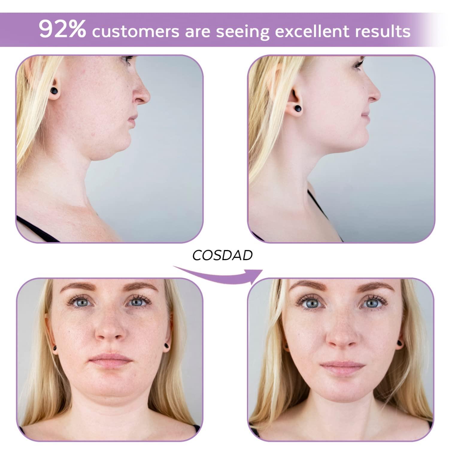 COSDAD COSDAD Reusable Double Chin Reducer Chin Strap Face Slimming Strap Face Slimmer Shaper for Women,Breathable Comfortable V Line Lifting Mask,Innovative Lifting Technology,One Fits All,Purple