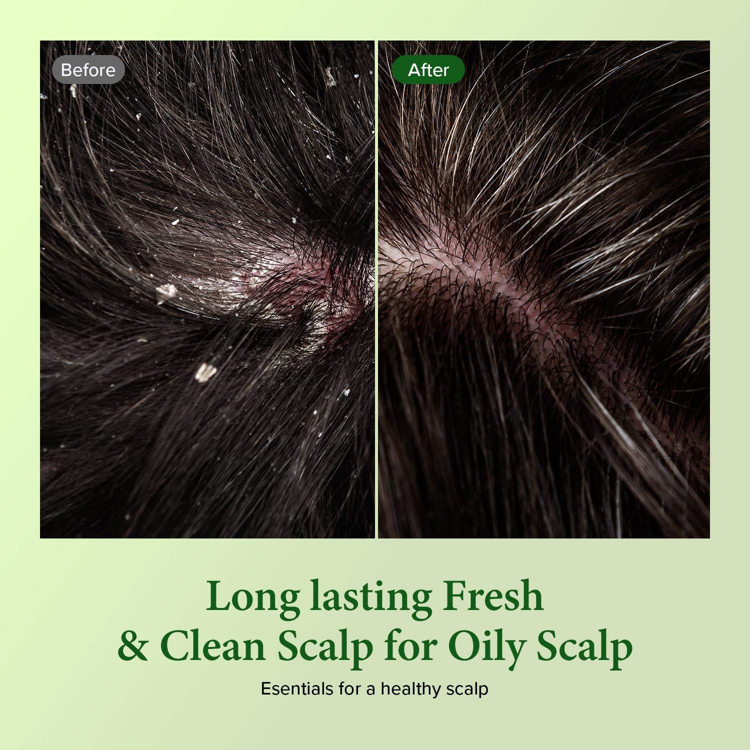 Kundal Kundal Tea Tree & Macadamia Deep Cleansing Shampoo - Korean Hair Care, Scalp Care, Tea Tree extract, For All hair Types 10.14fl oz each (Pack of 2) (Jasmine Woody)