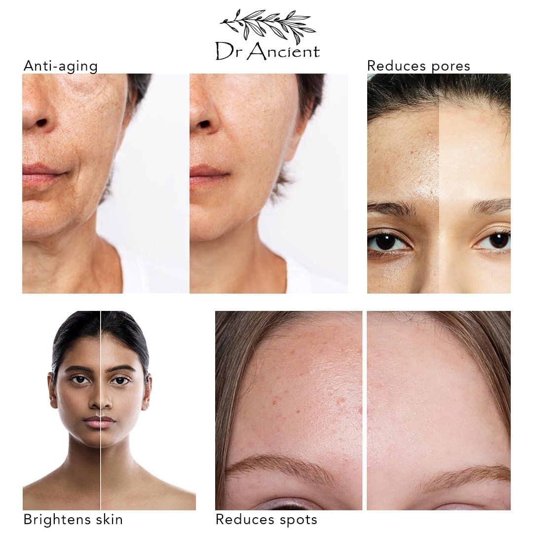 Dr.Ancient Dr.Ancient Donkey Milk Soap Bar Organic Natural Traditional Handmade Antique - Anti Ageing, Moisturizer - Absolutely No Chemicals! Pure Natural Soaps! 5 Ounce (Pack of 4)