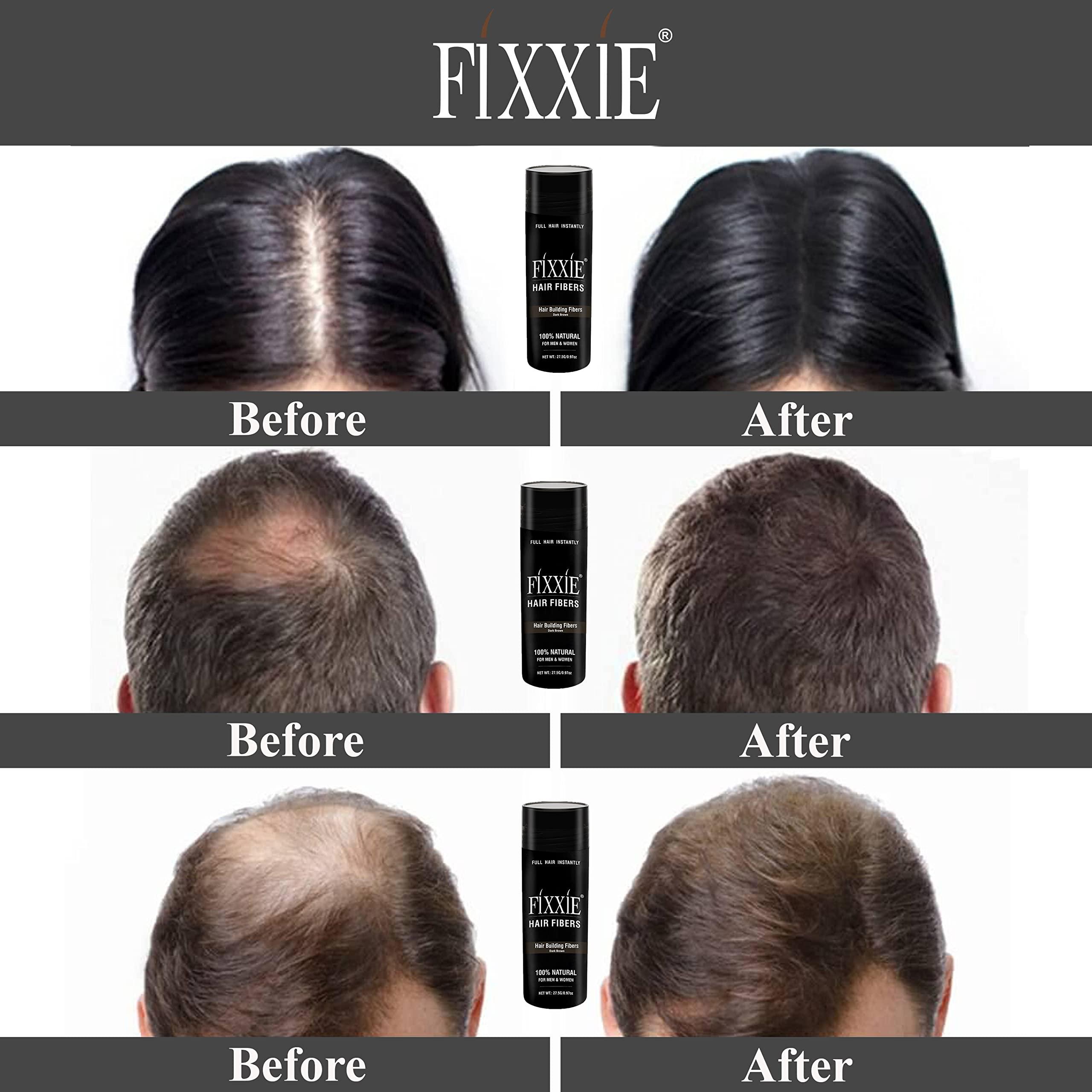 FIXXIE, fixxie FIXXIE Hair Fibers Dark Blonde for Thinning Hair 27.5g Bottle, Concealer for Hair Loss, Men and Women, Naturally Thicker Looking With Keratin Fibres