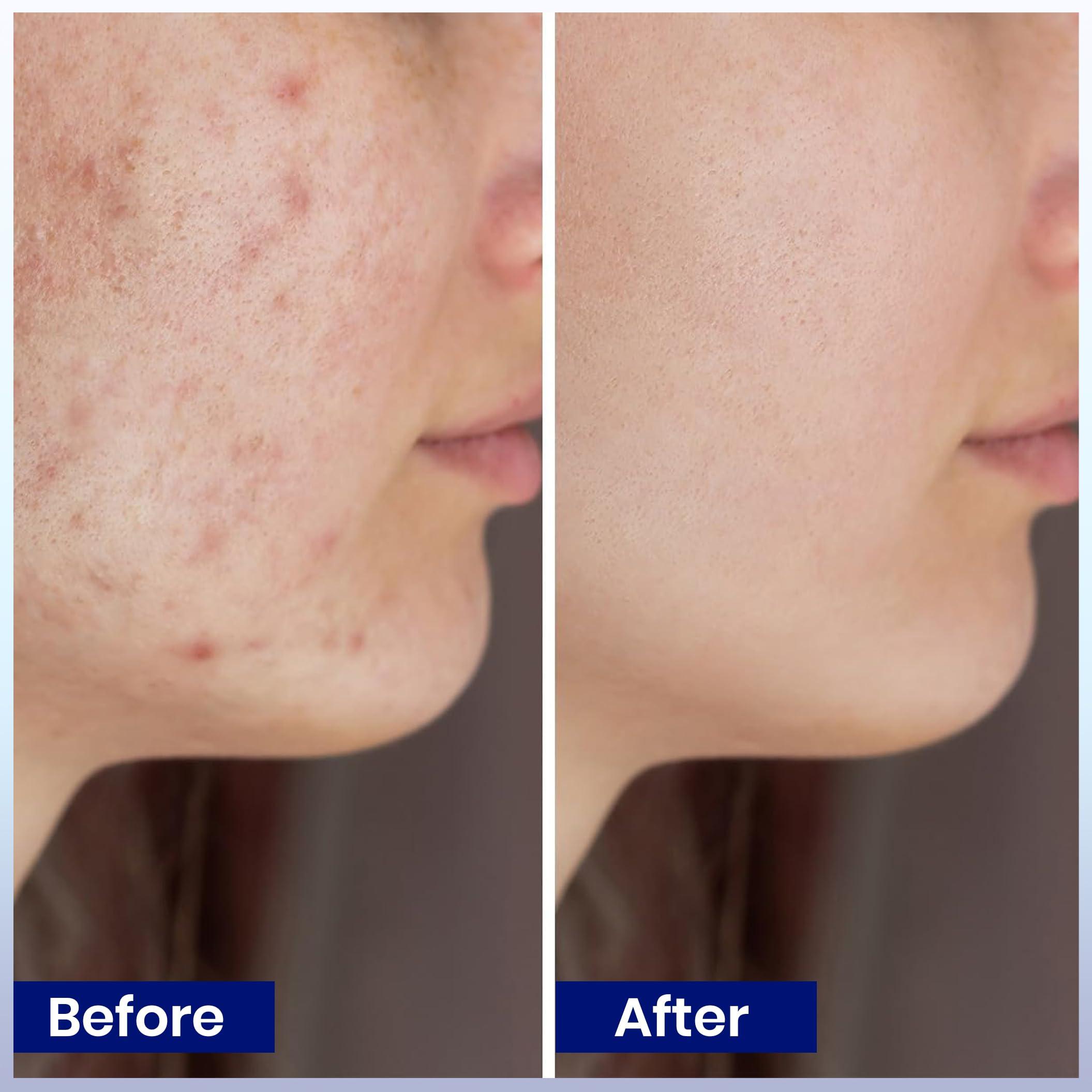 UNIQUE CONCENTRATIONS Dead Sea Mud Mask for Face and Body - Deep Cleansing, Exfoliating, Detoxifying for Acne, Blackheads, Oily Skin, and Pore Clearing - 100% Natural Mineral-Rich Formula for Men and Women - 8.8 oz