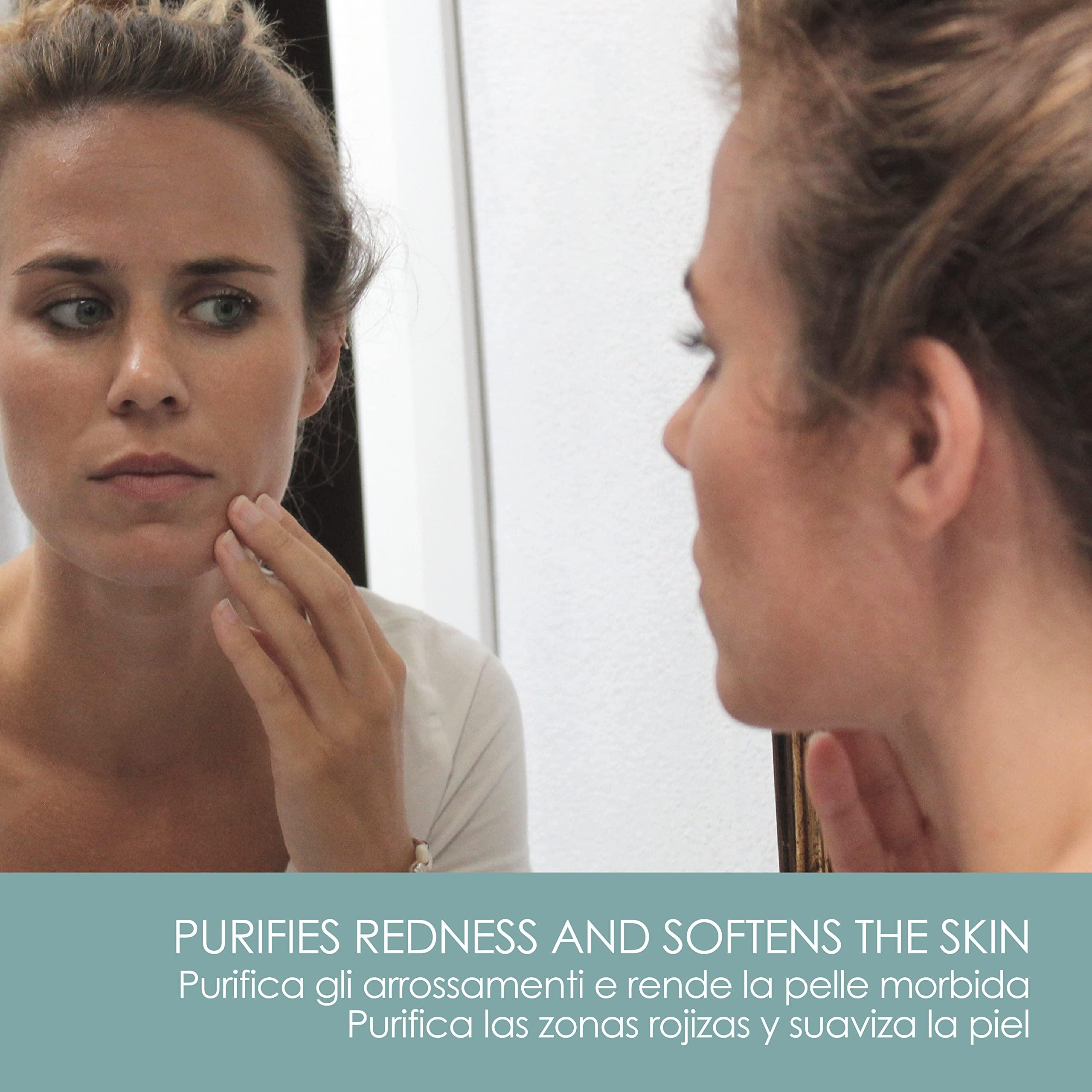 LYNPHA VITALE LYNPHA VITALE Sulfur Soap Bar - 100% Handmade Natural Bar Soap with Coconut Oil - Sulphur Soap ideal to Nourish and Heal Oily Skins - 3,5 oz - 3 Soaps Pack