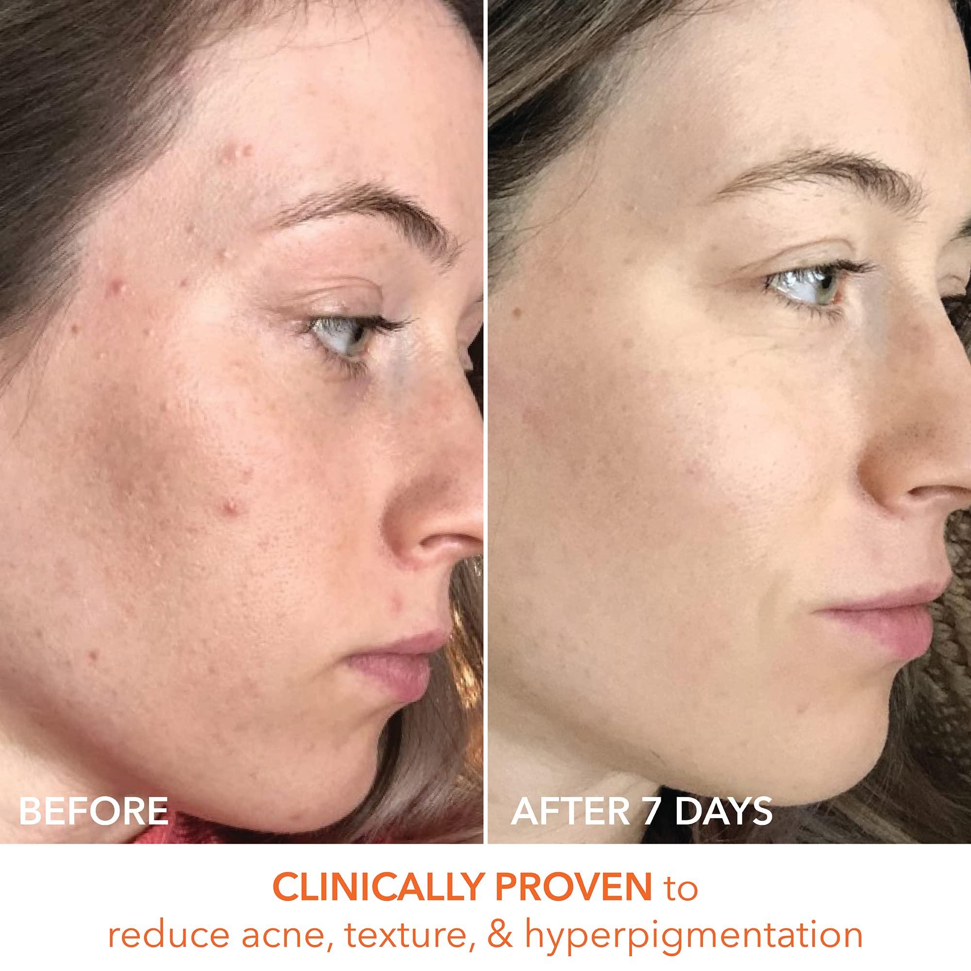 Dr Dennis Gross Alpha Beta Universal Daily Peel by Dr. Dennis Gross for Unisex - 60 Pc Pads